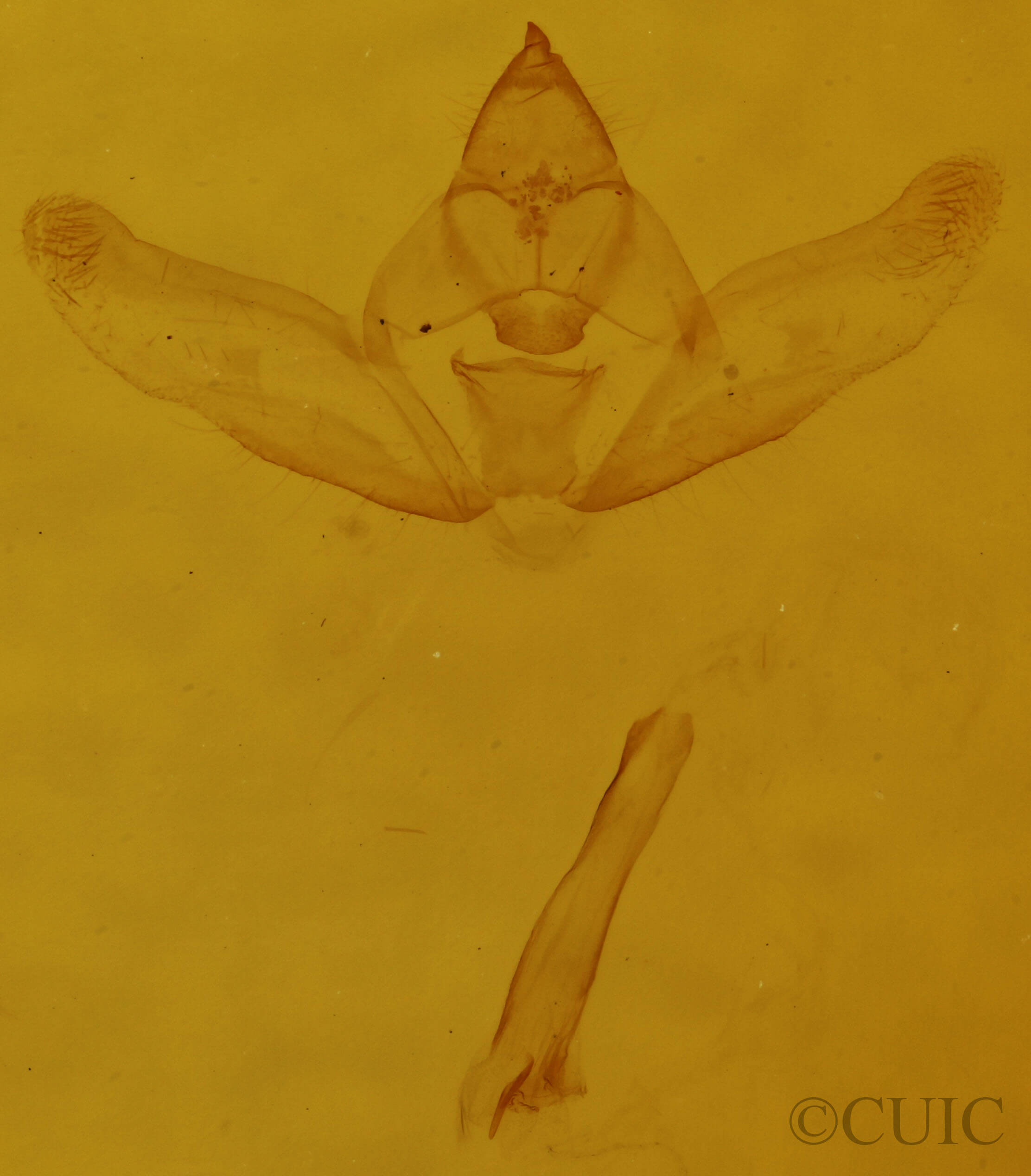 genitalia view of adult Hypagyrtis piniata