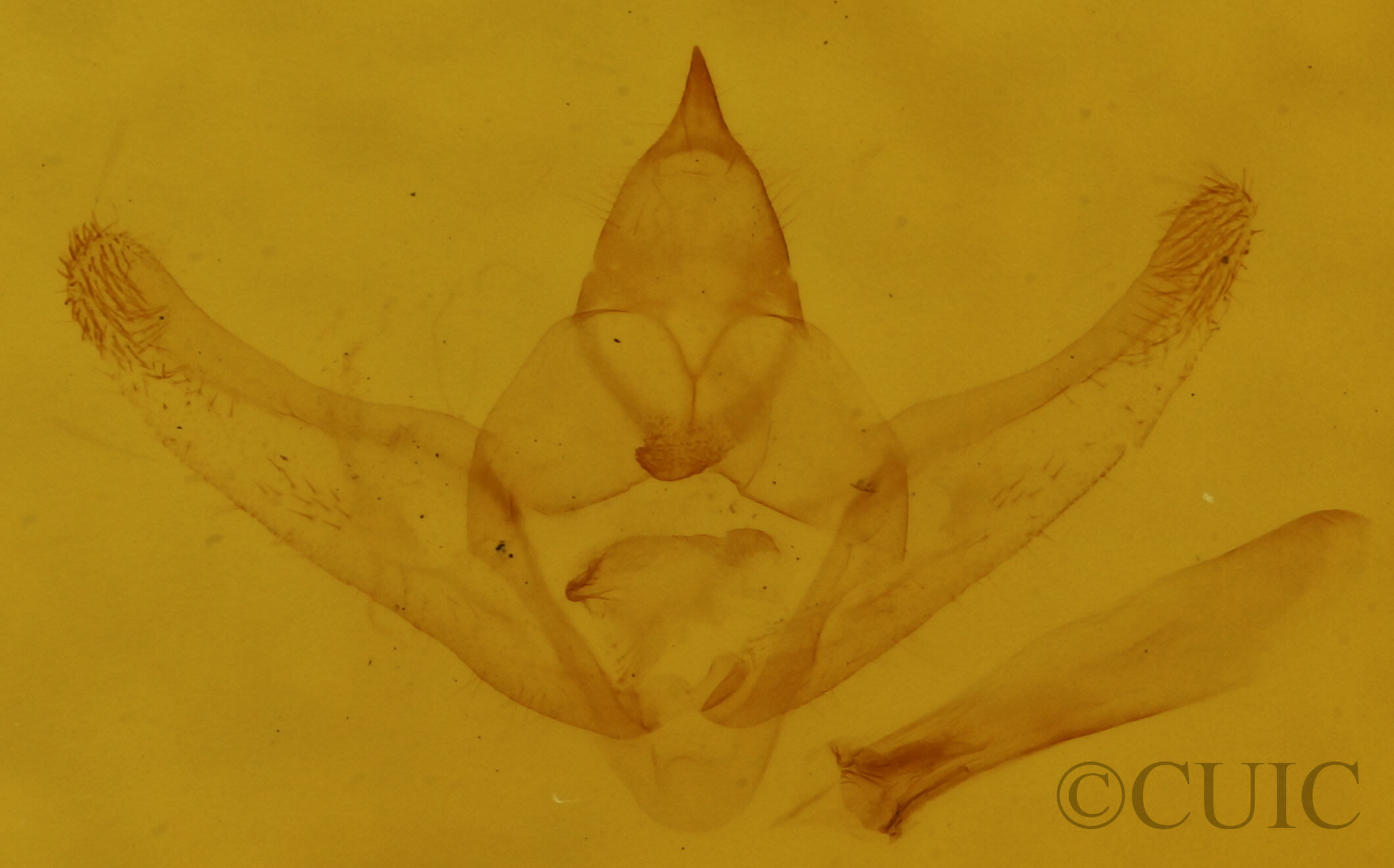 genitalia view of adult Hypagyrtis unipunctata