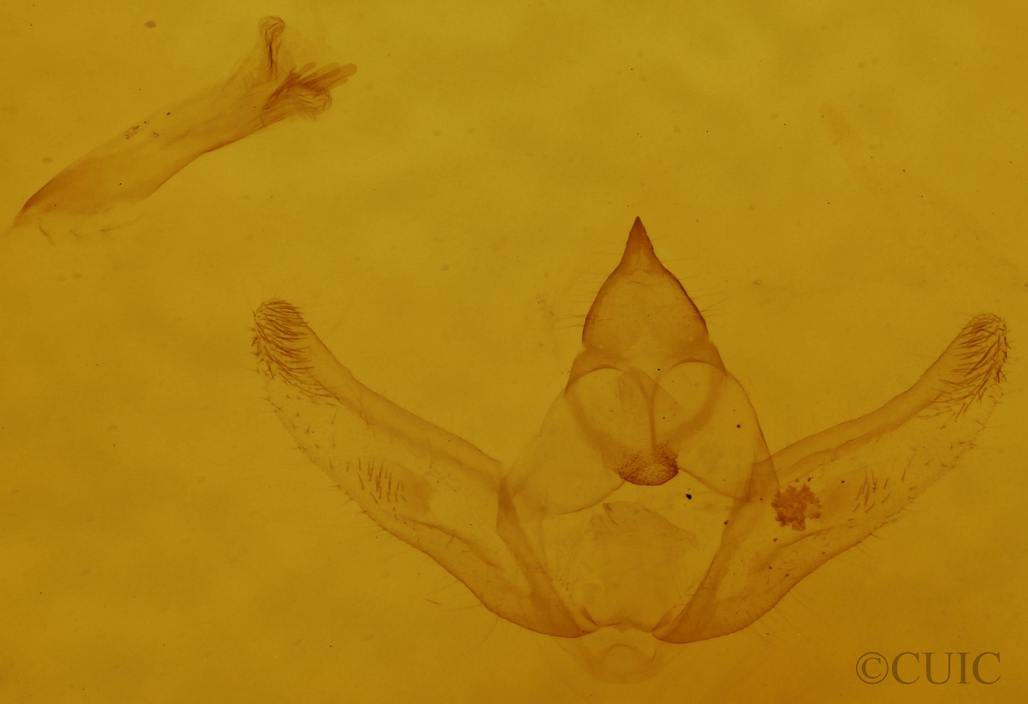 genitalia view of adult Hypagyrtis unipunctata