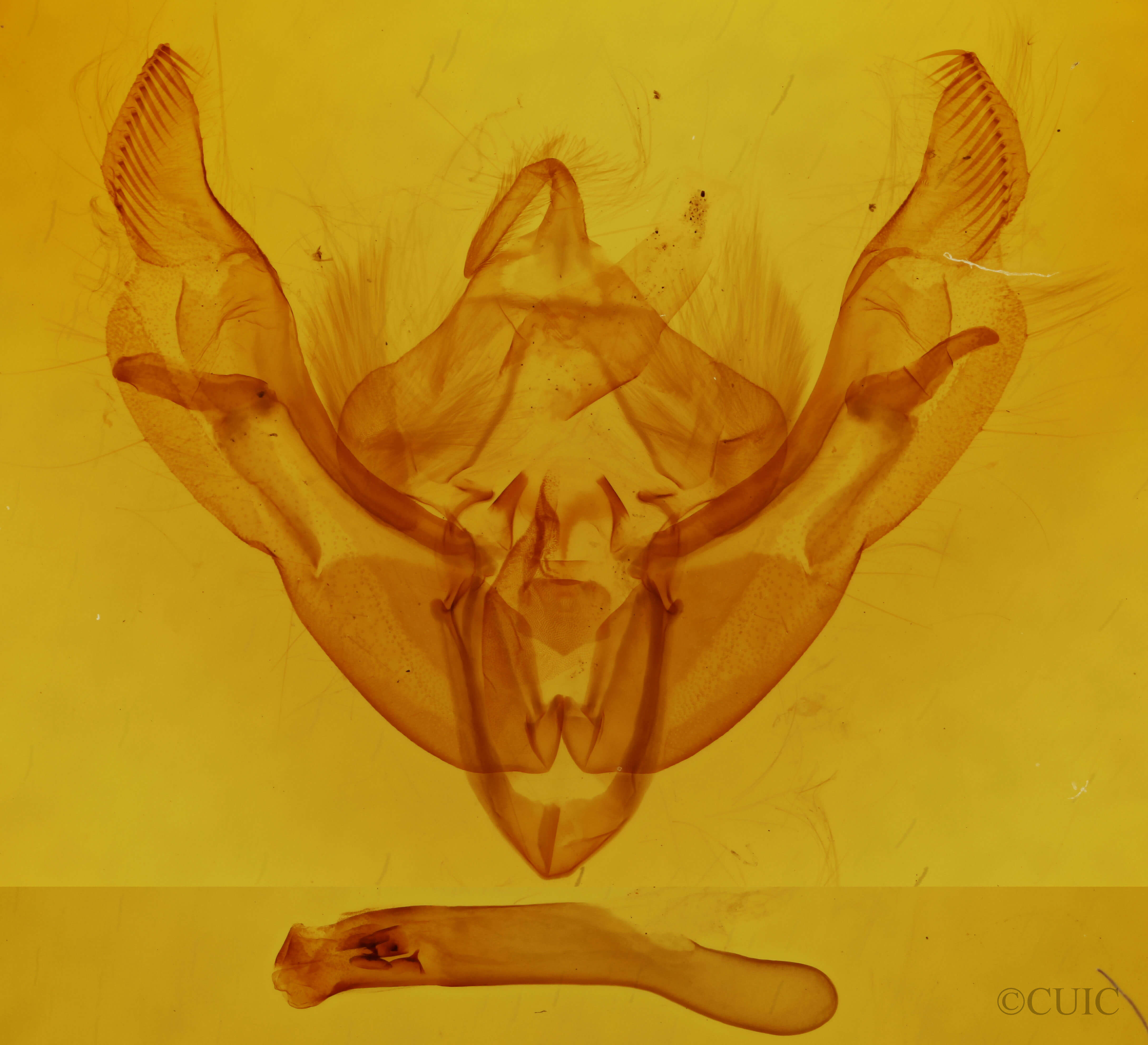 genitalia view of adult Ipimorpha pleonectusa