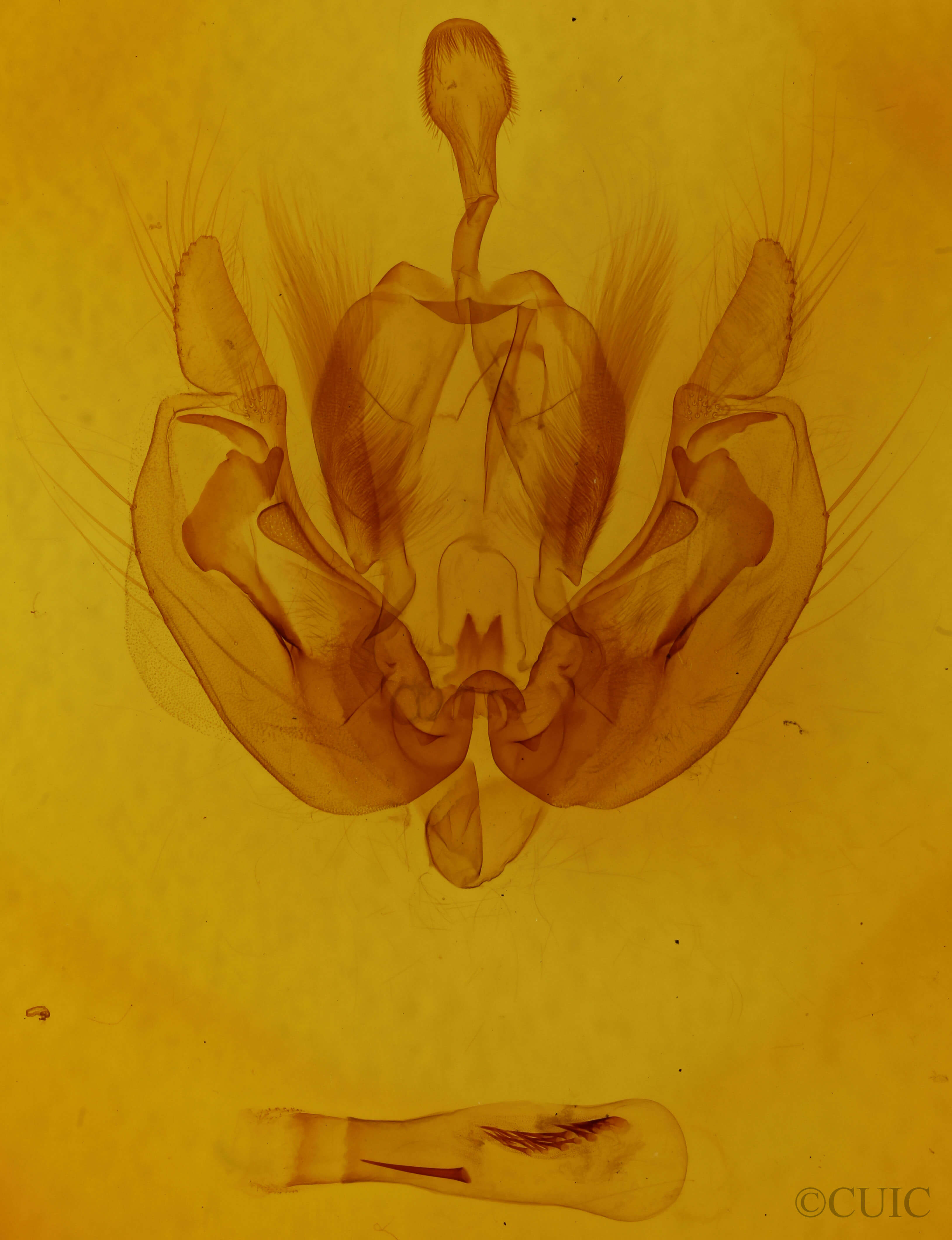 genitalia view of adult Leucania ursula