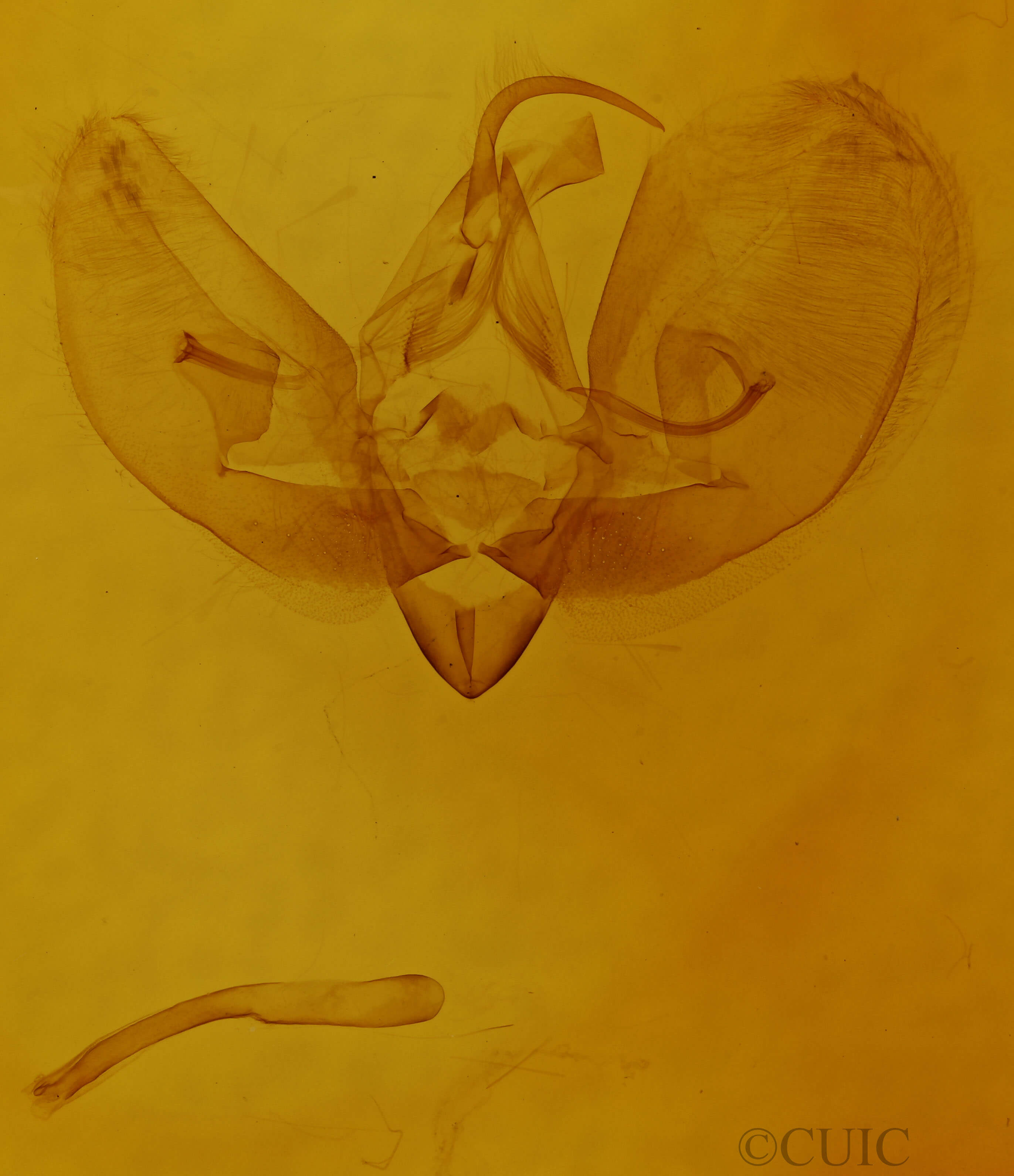 genitalia view of adult Leuconycta diphteroides