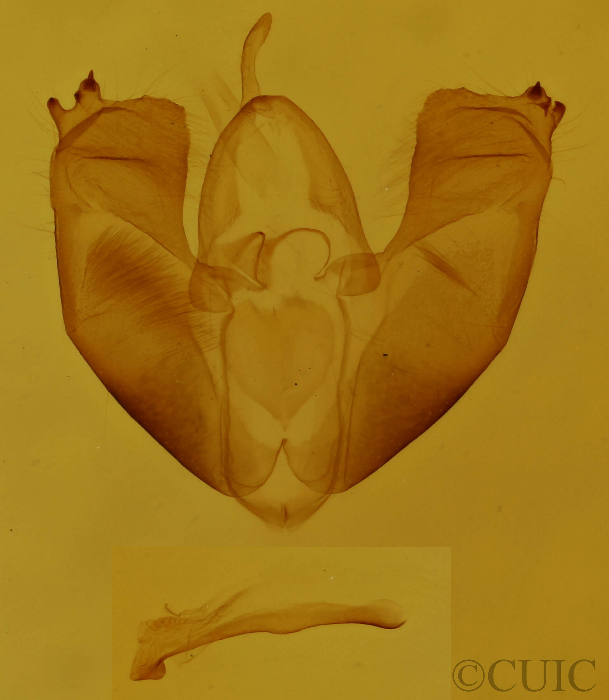 genitalia view of adult Maliattha concinnimacula