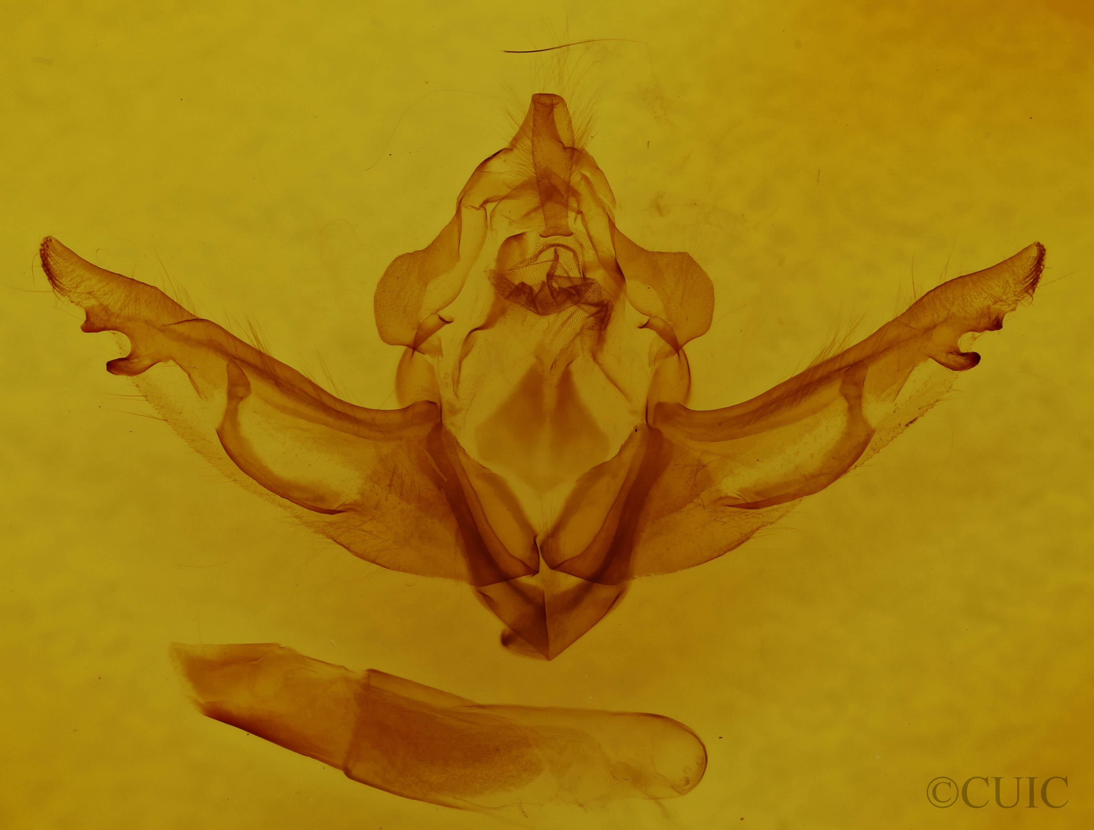 genitalia view of adult Lithophane dilatocula