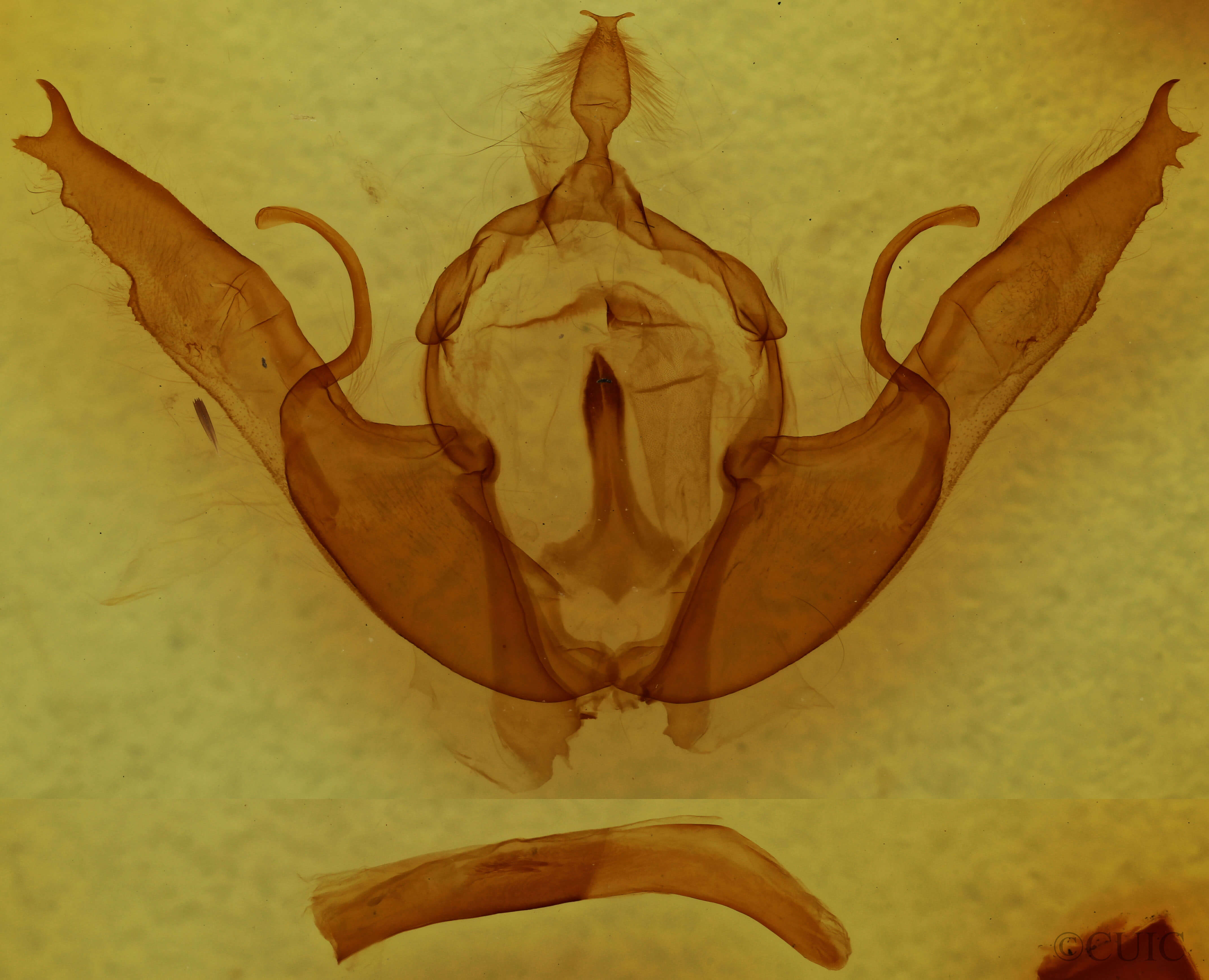 genitalia view of adult Lithophane oriunda