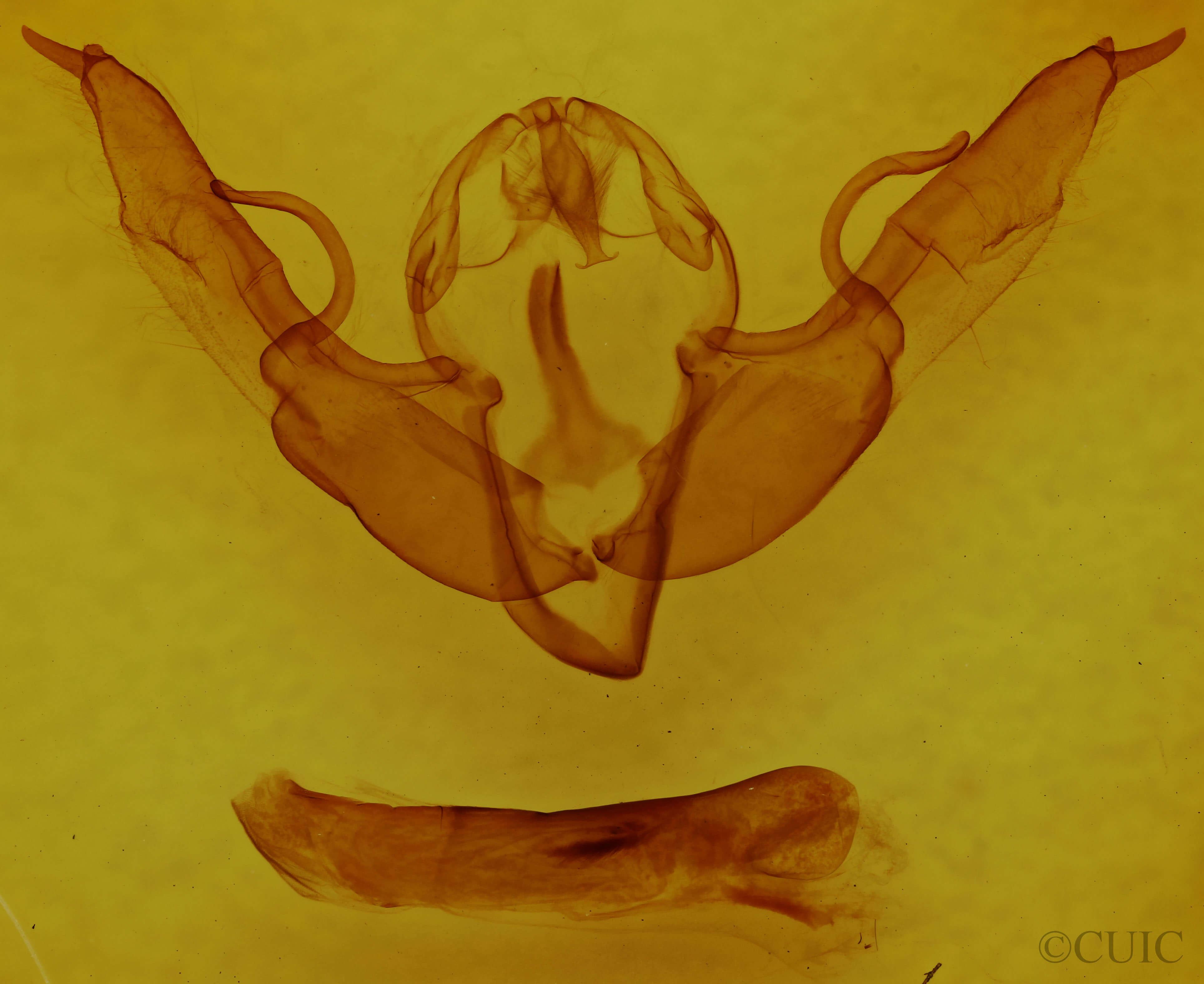 genitalia view of adult Lithophane pertorrida