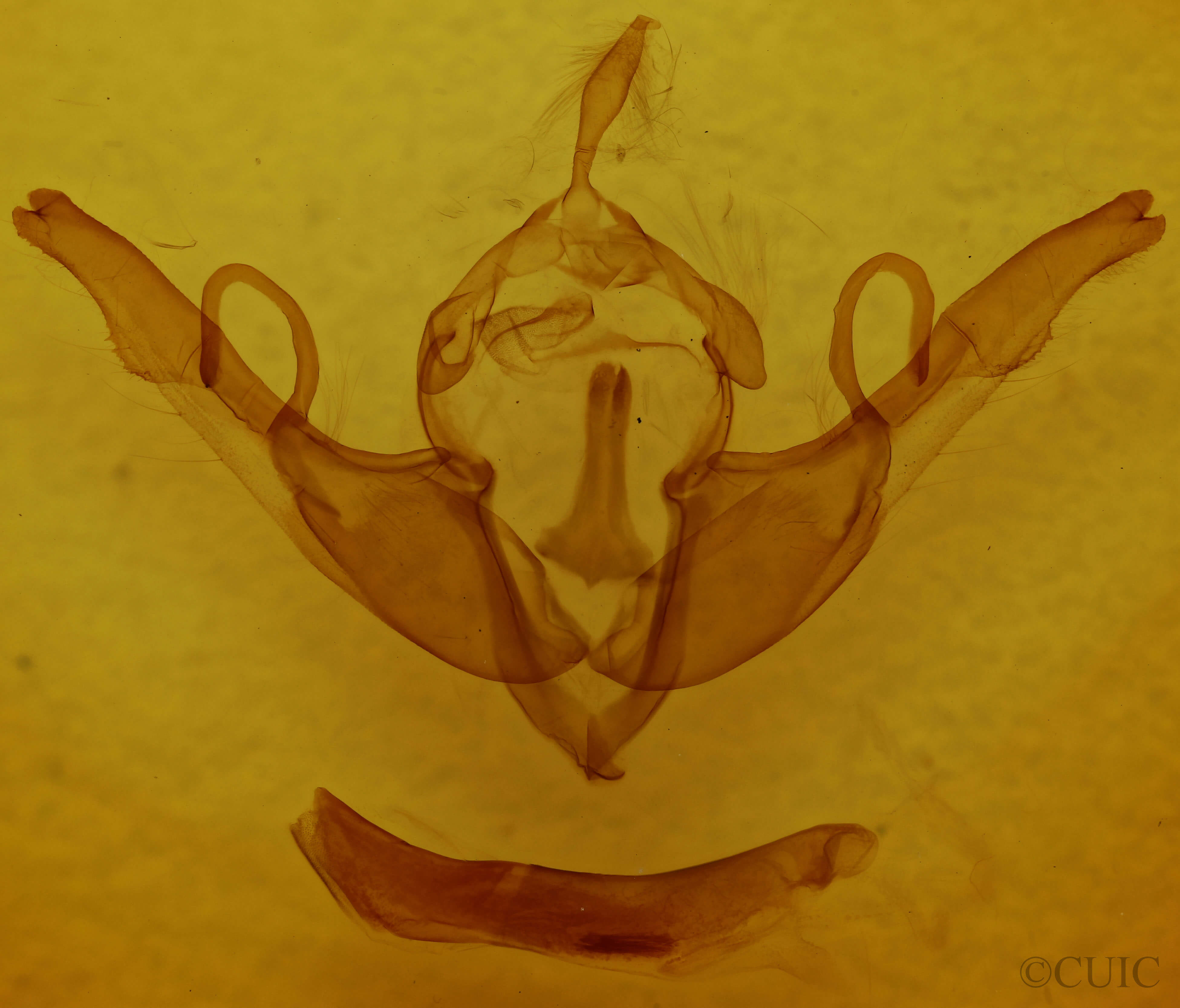 genitalia view of adult Lithophane unimoda