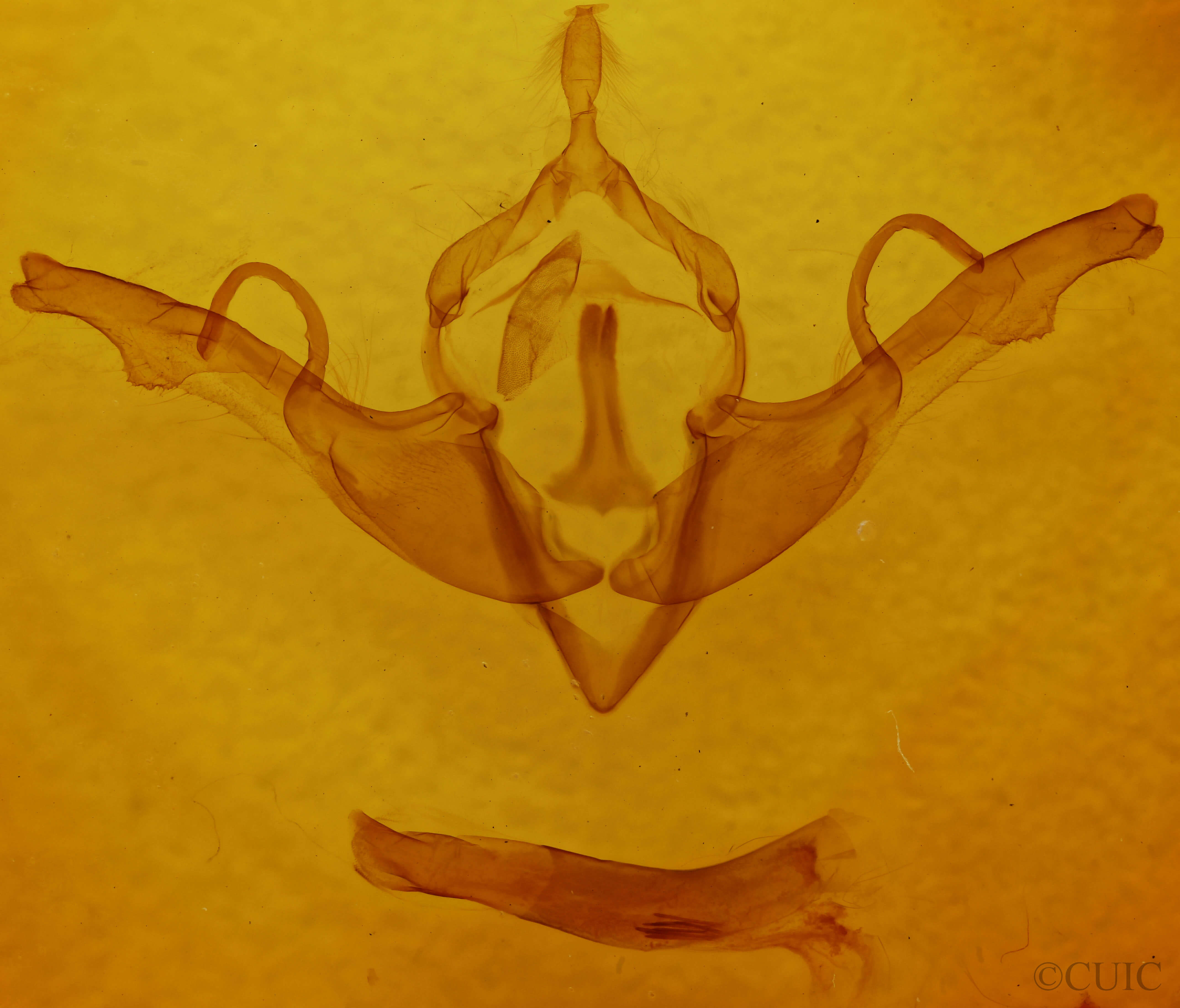 genitalia view of adult Lithophane unimoda