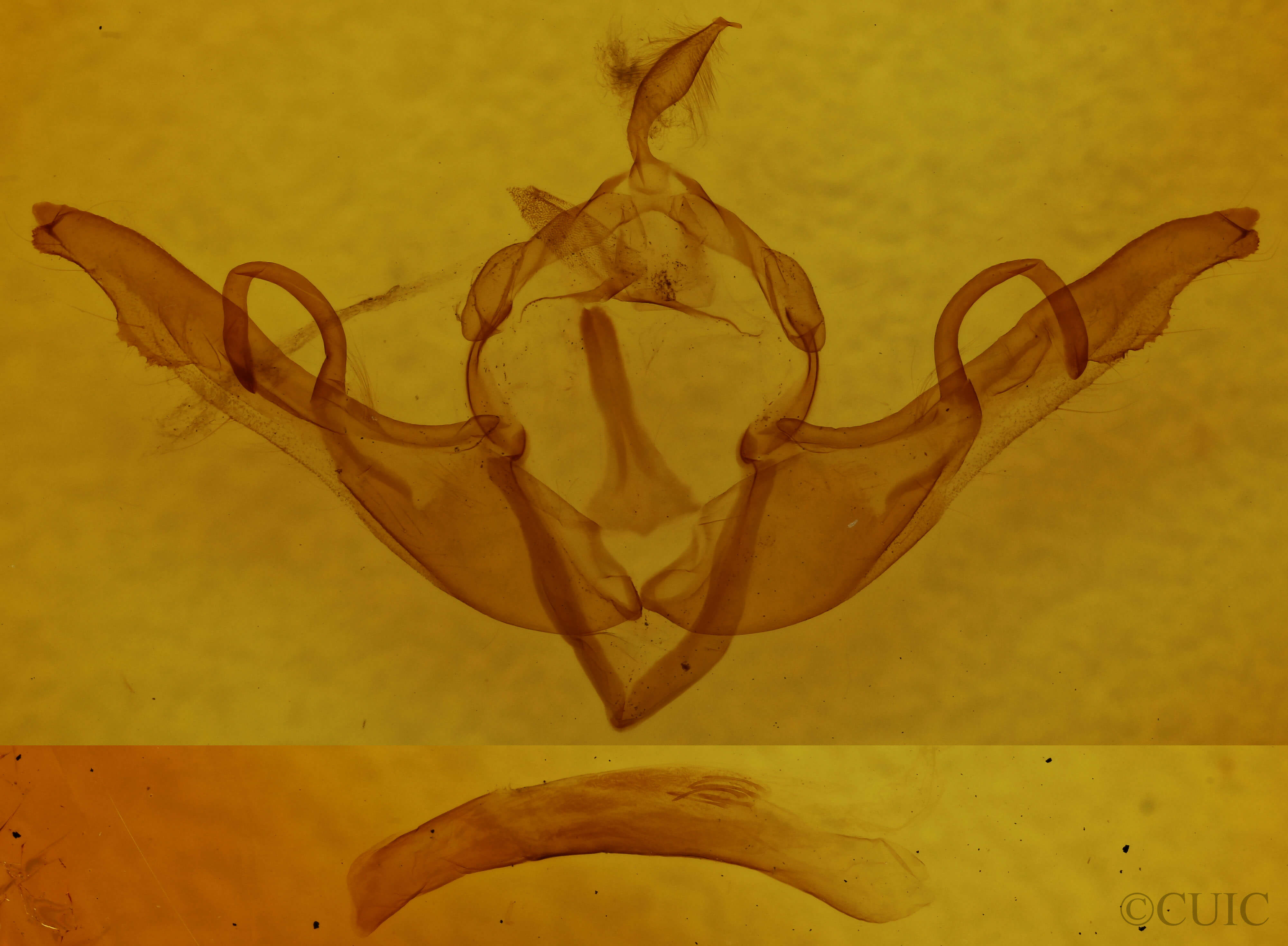 genitalia view of adult Lithophane unimoda