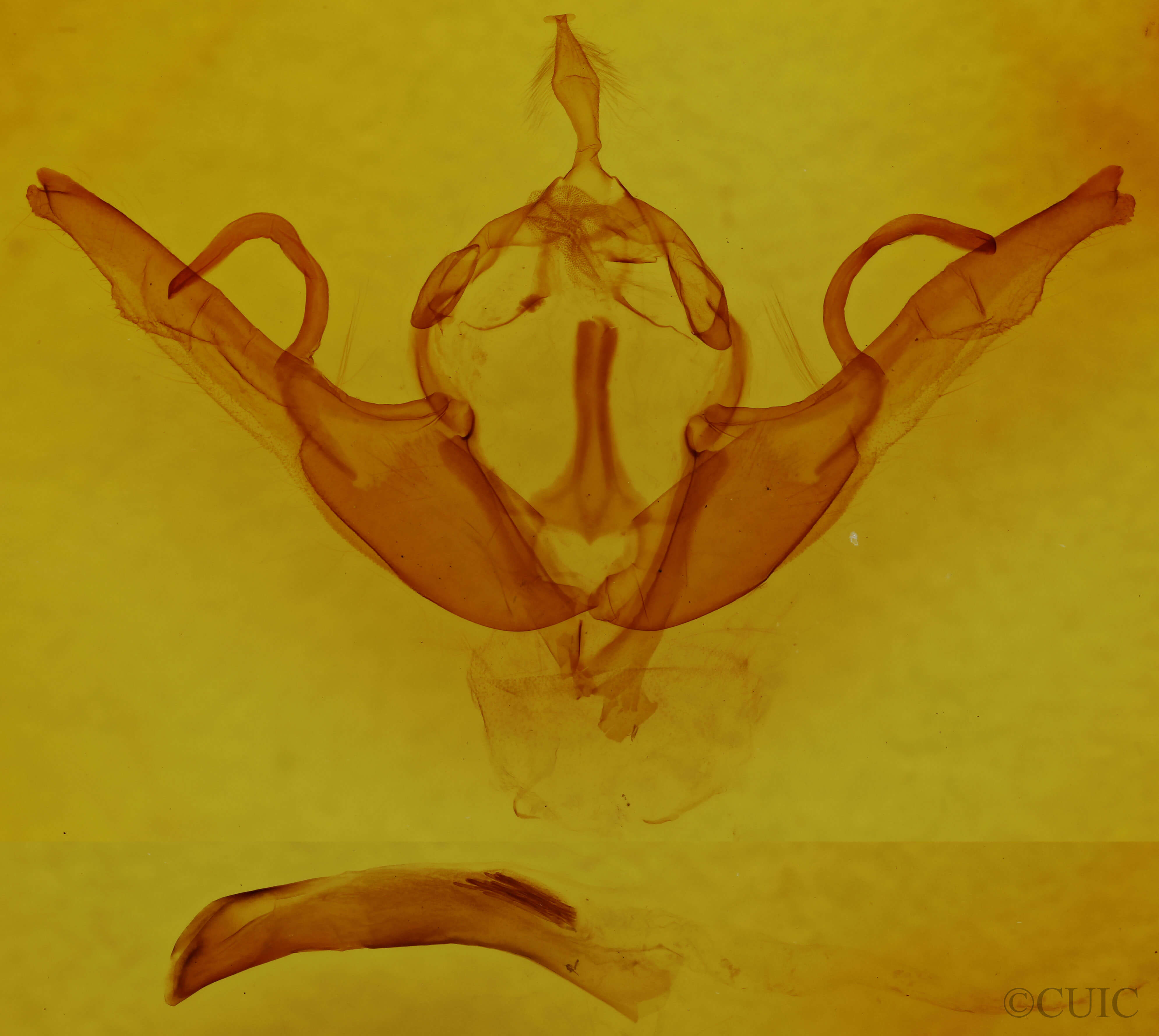 genitalia view of adult Lithophane unimoda