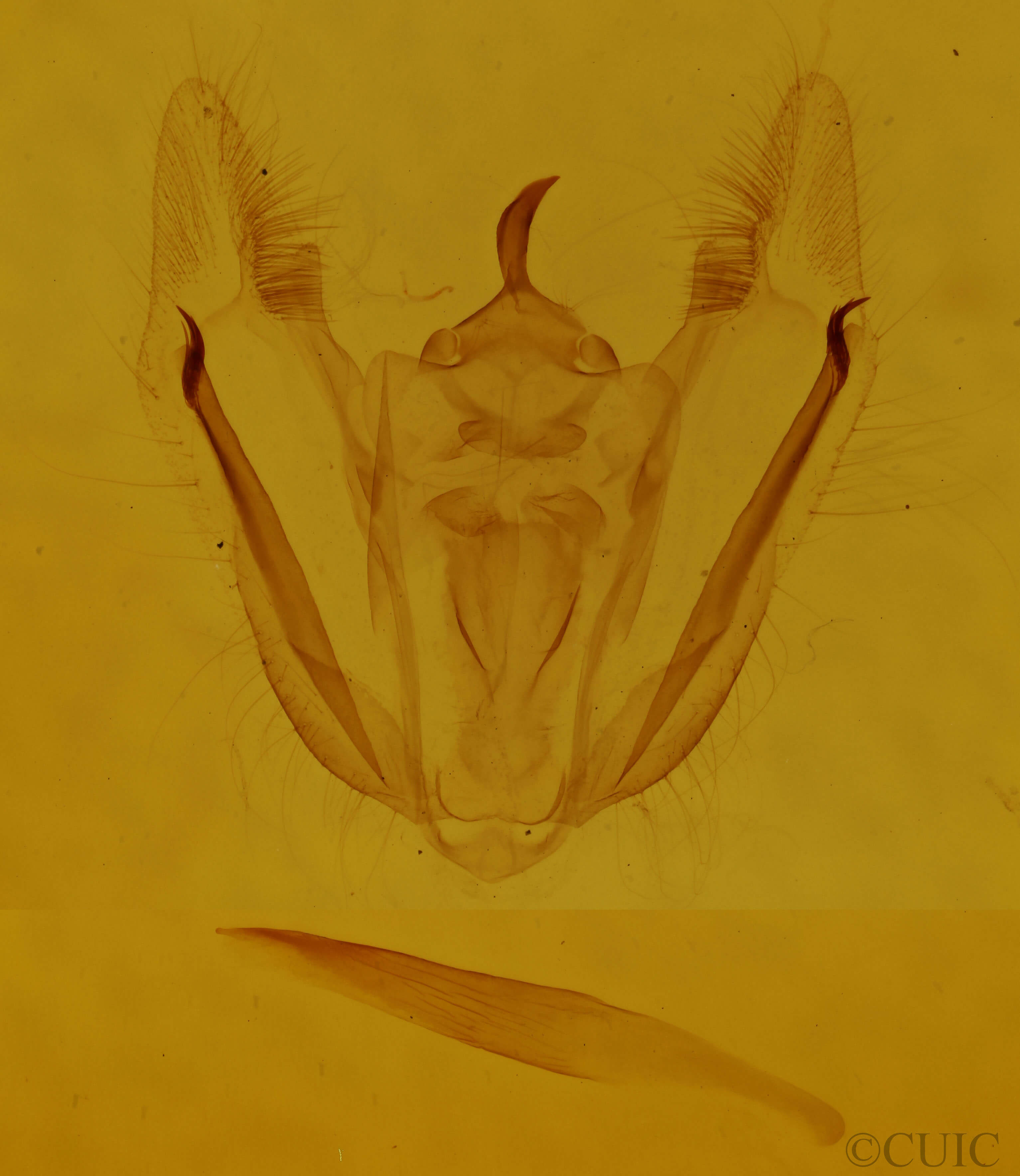 genitalia view of adult Melanolophia canadaria