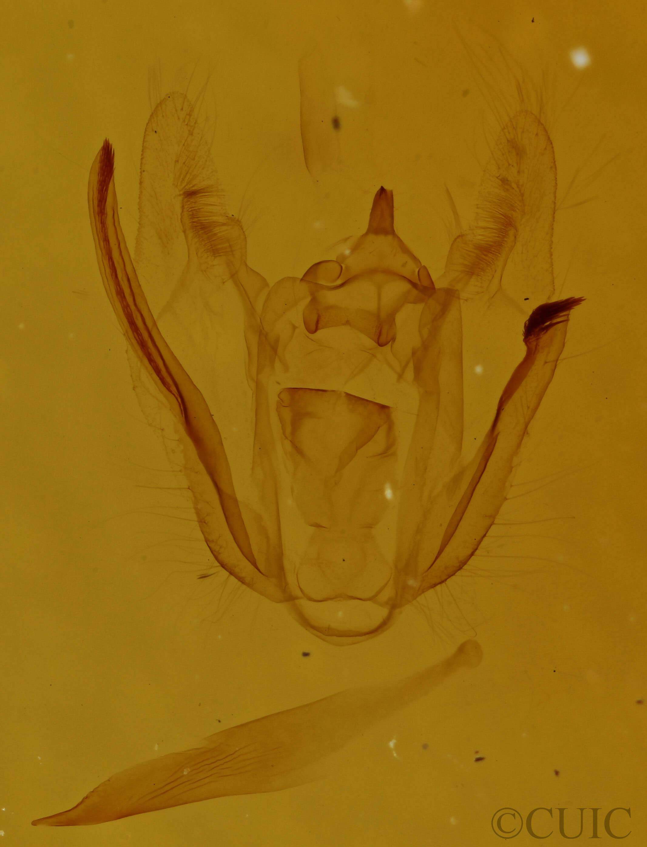 genitalia view of adult Melanolophia signataria