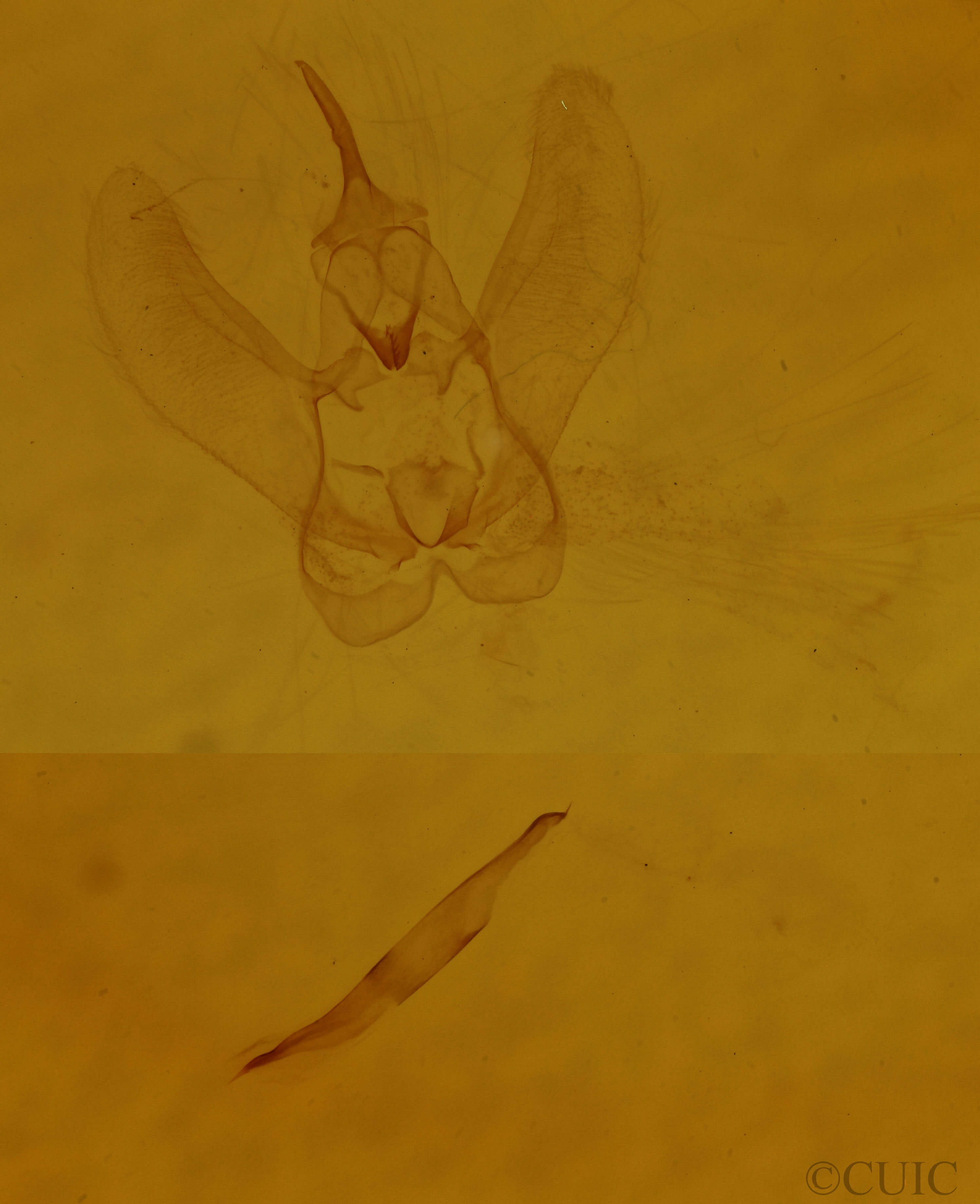 genitalia view of adult Metanema determinata