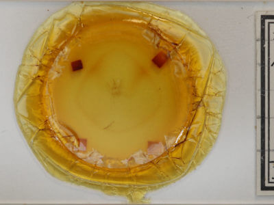 slide view of adult Metanema determinata