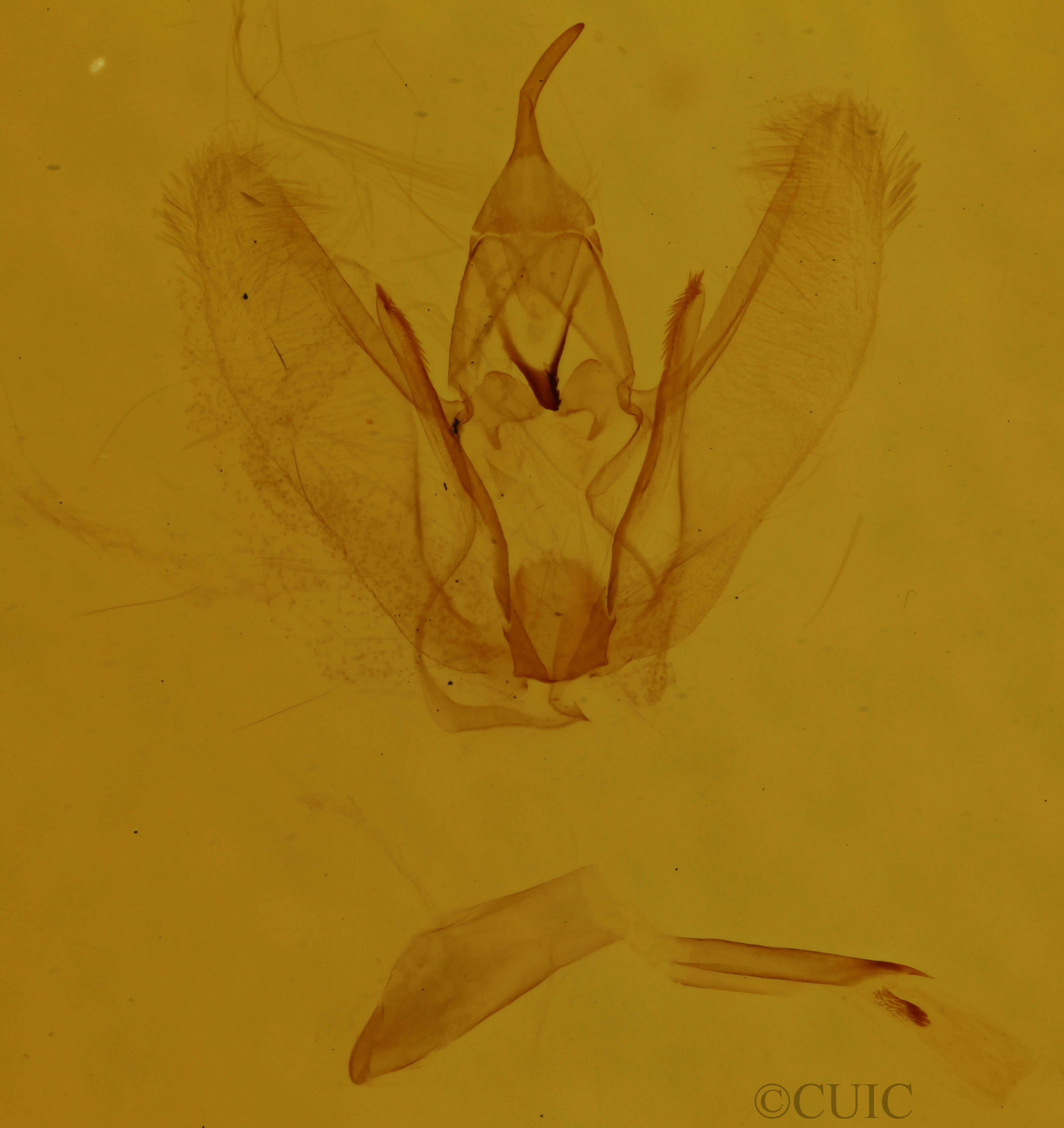 genitalia view of adult Metanema inatomaria