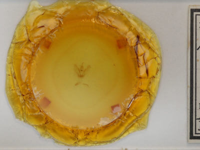 slide view of adult Metanema inatomaria