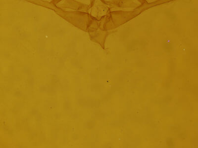 genitalia view of adult Nola ovilla