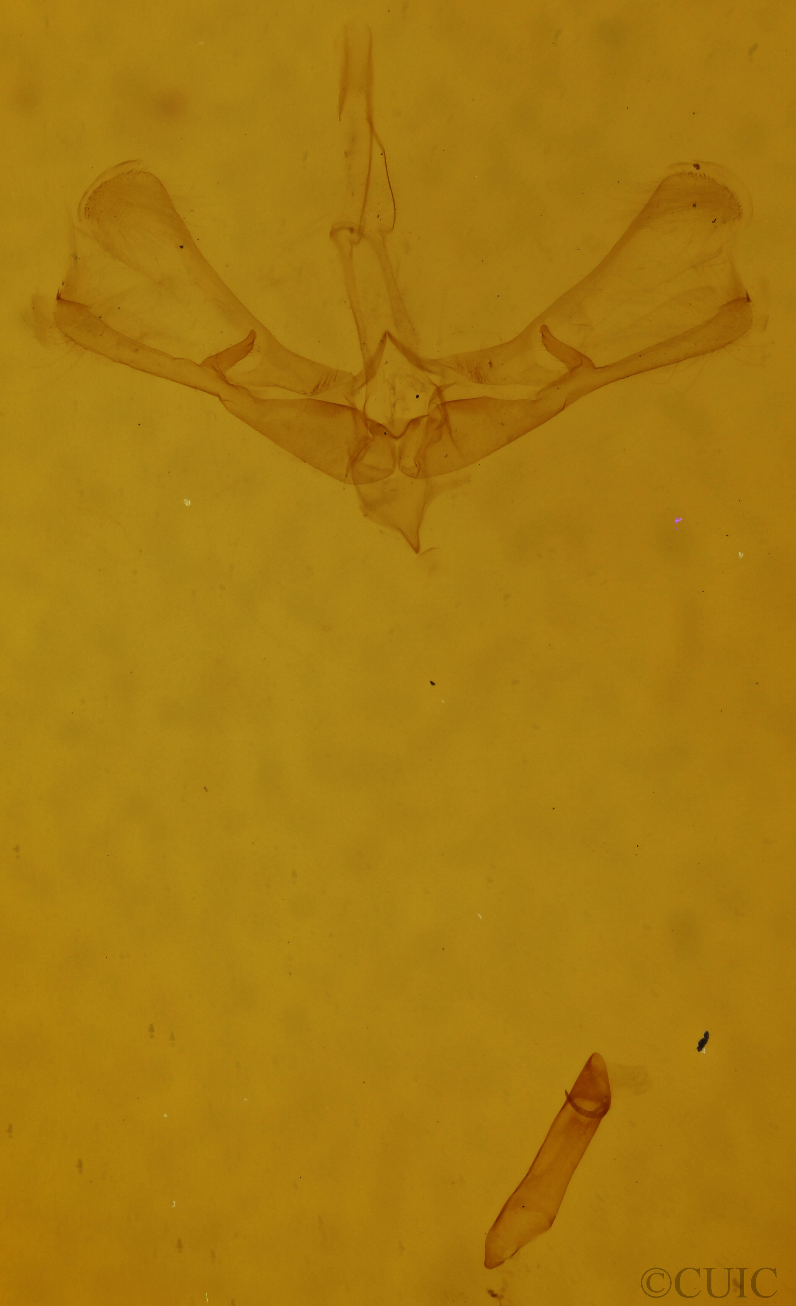 genitalia view of adult Nola ovilla