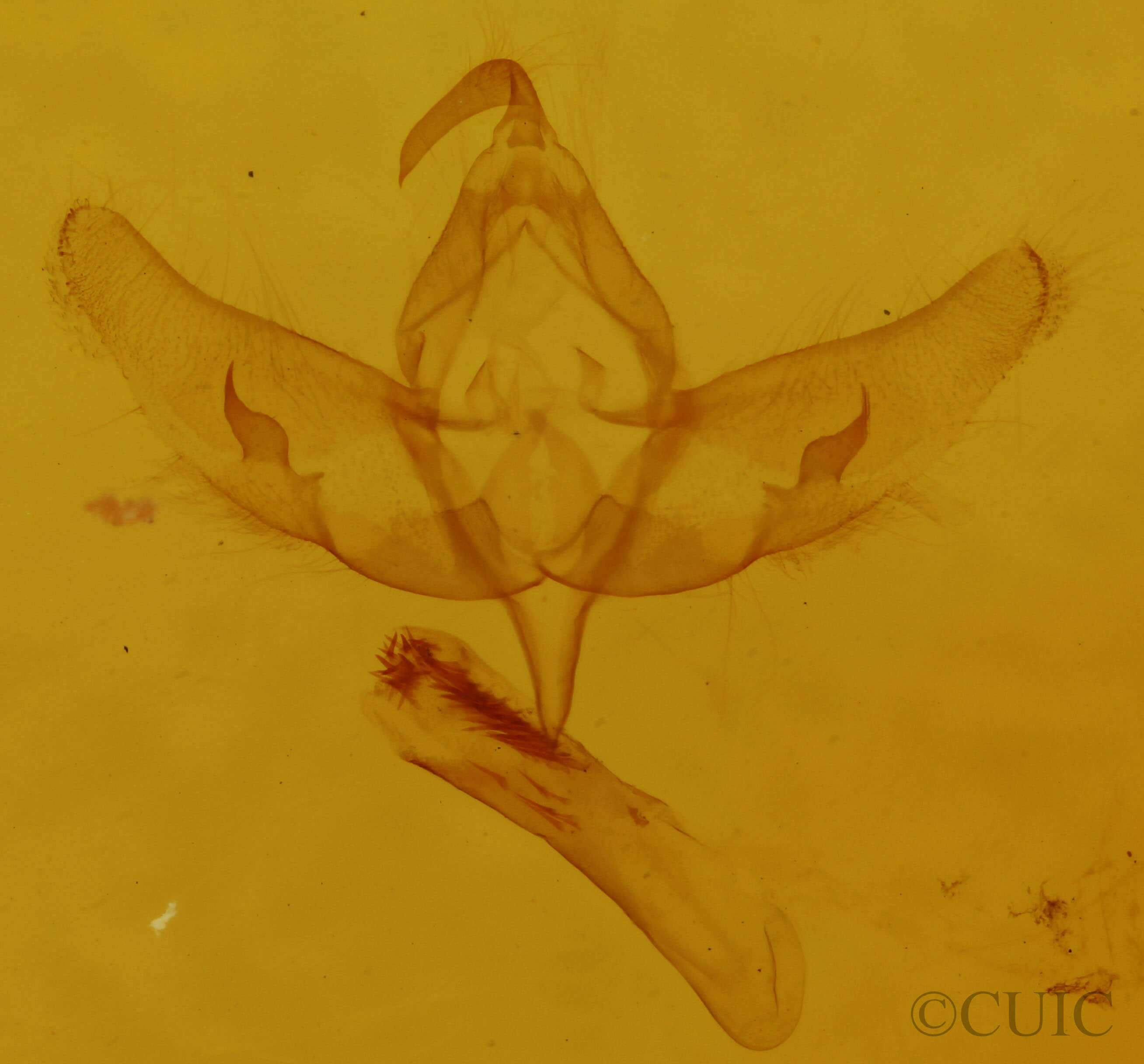 genitalia view of adult Sympistis nita