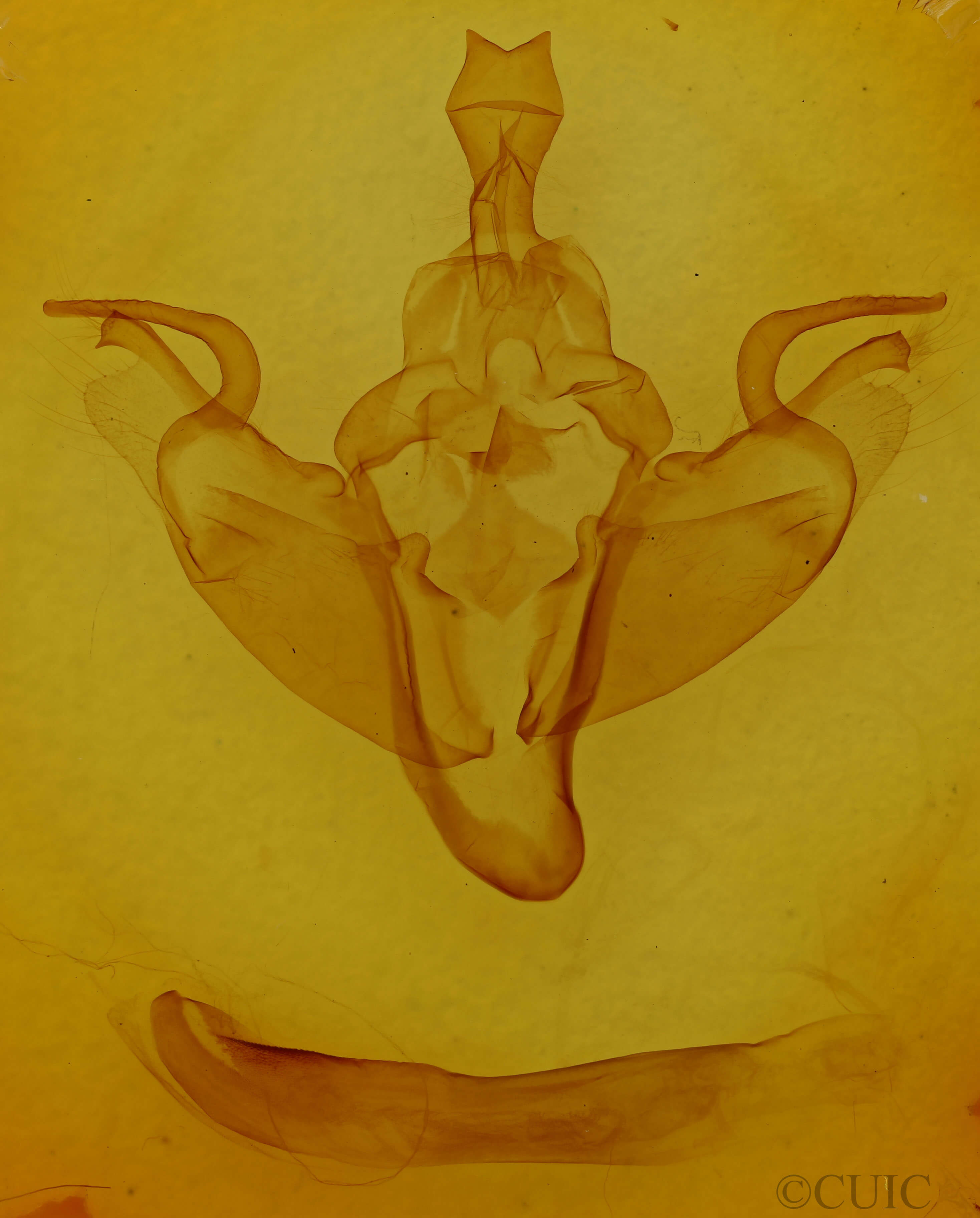 genitalia view of adult Orbona fragariae