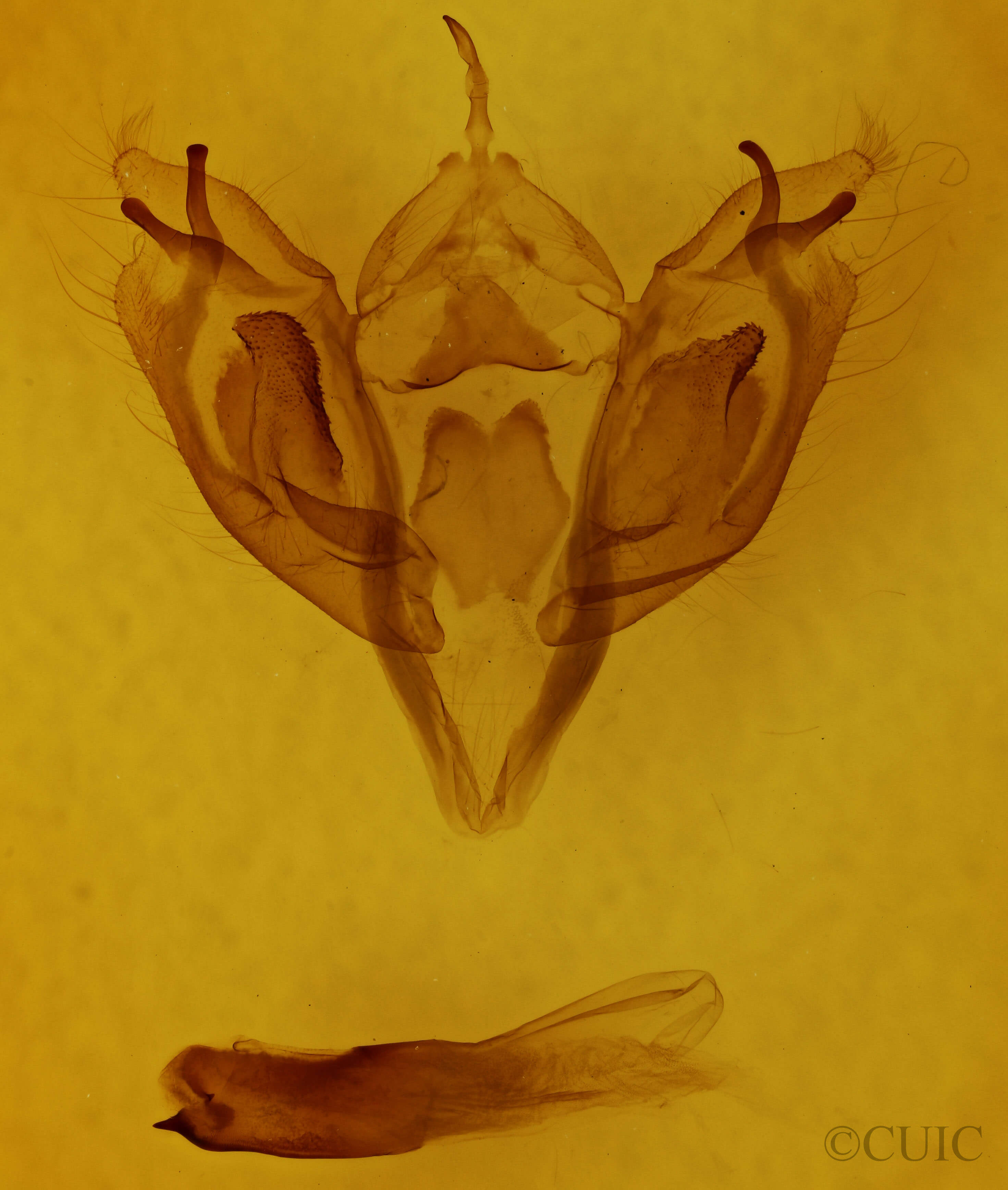 genitalia view of adult Orthosia rubescens