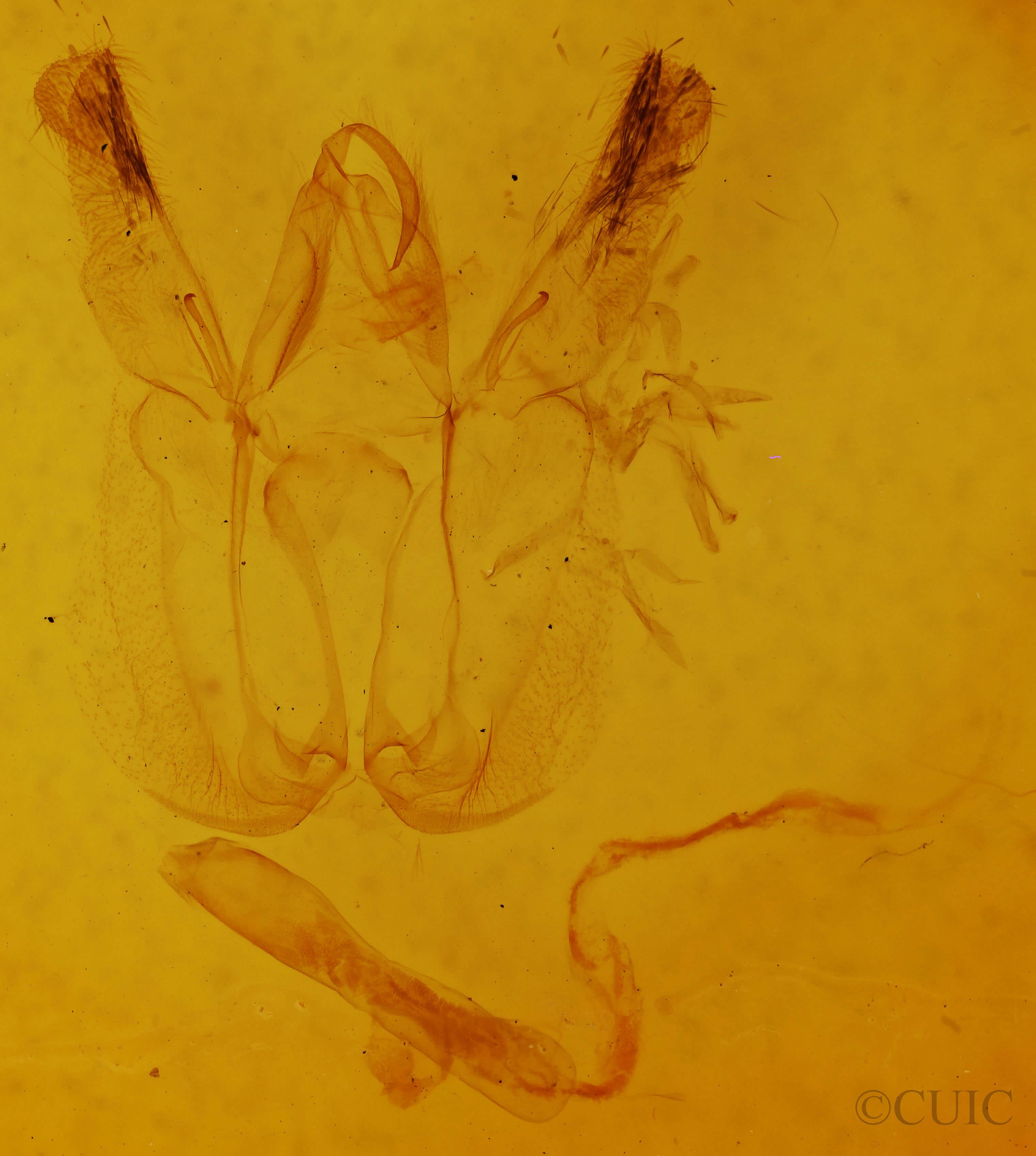 genitalia view of adult Perigea glaucoptera