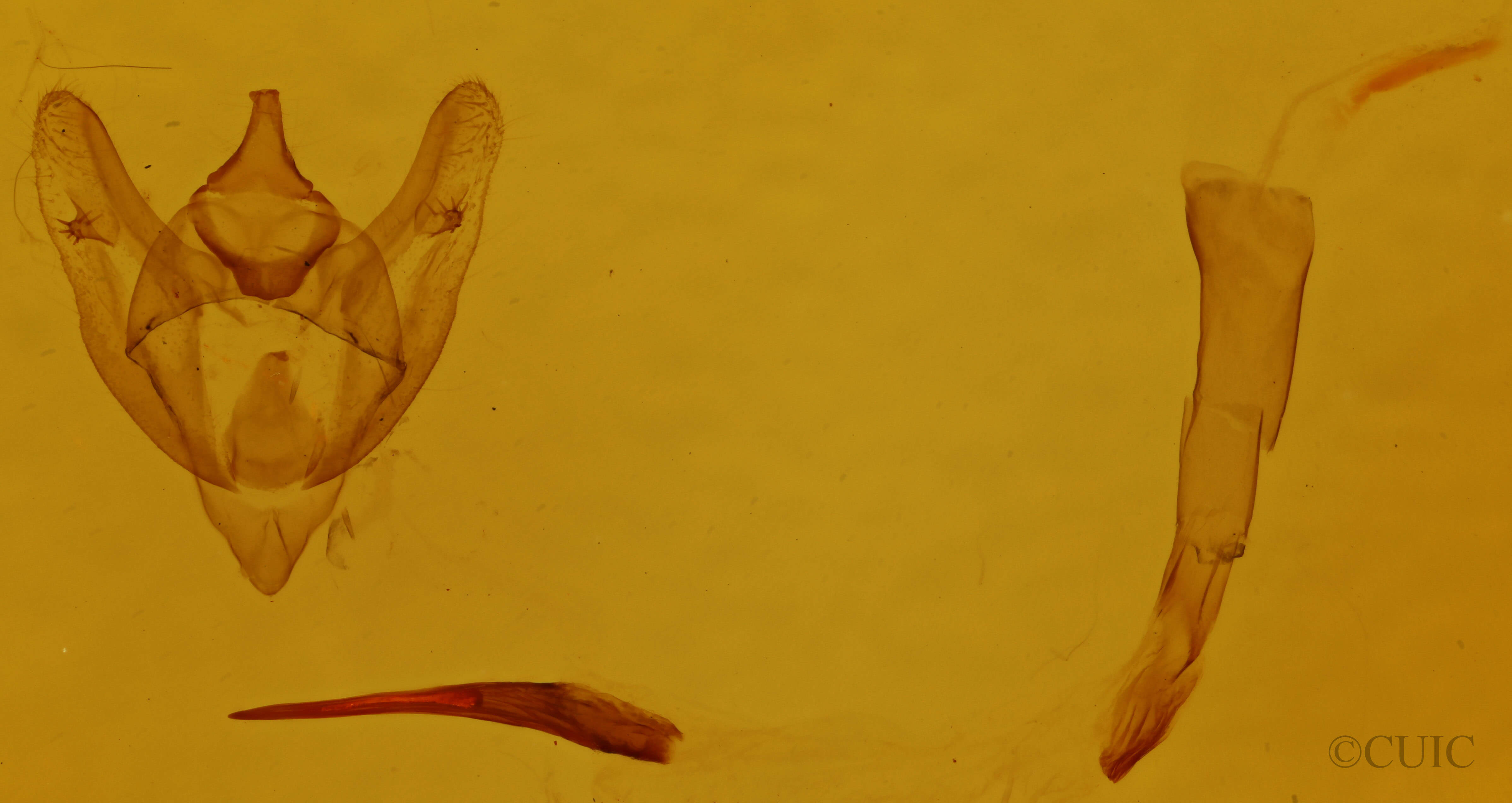 genitalia view of adult Phigalia strigataria