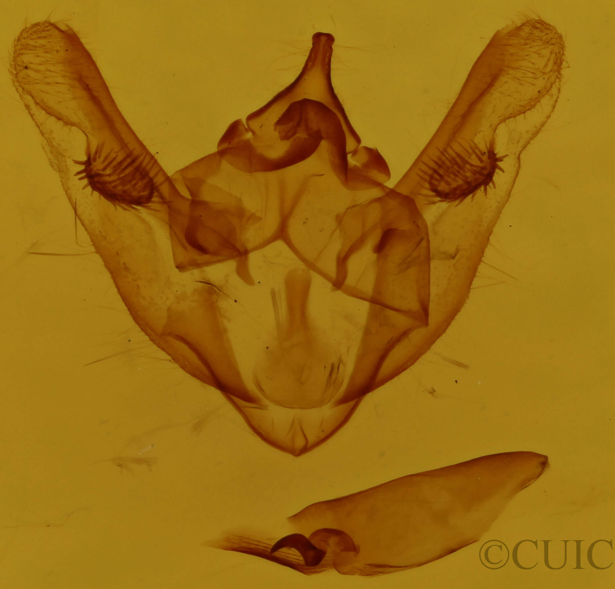 genitalia view of adult Phigalia titea