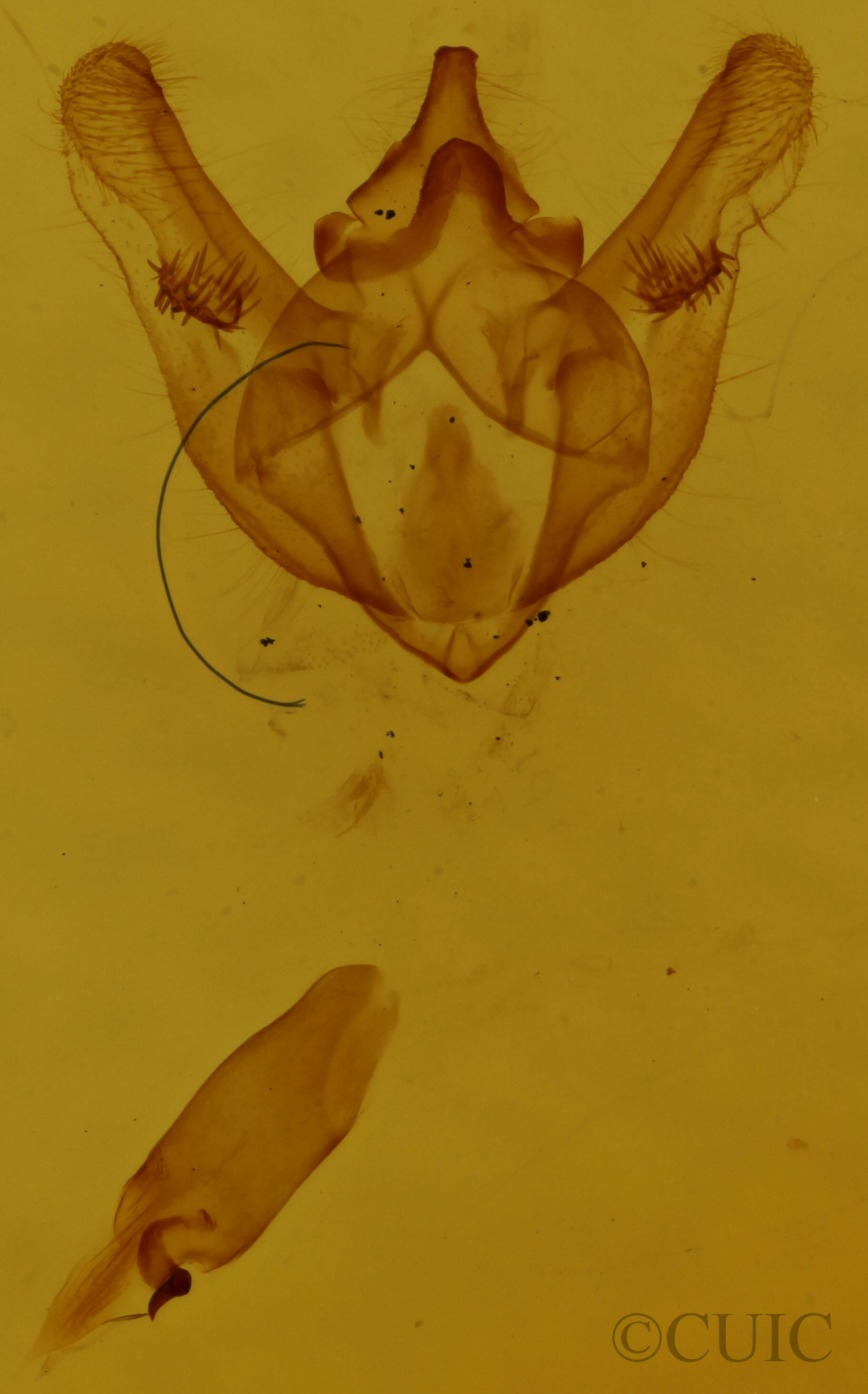 genitalia view of adult Phigalia titea