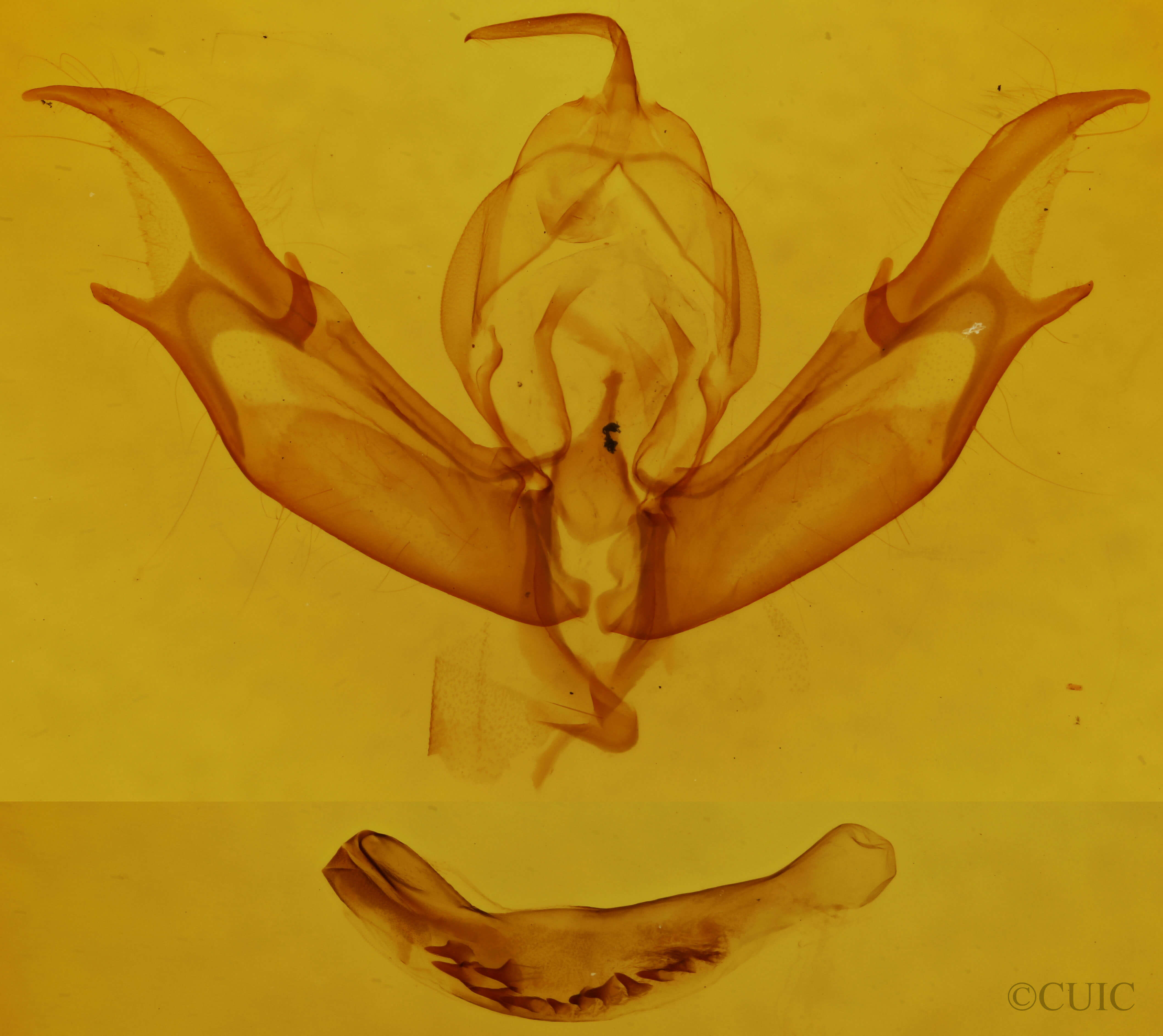 genitalia view of adult Caradrina multifera