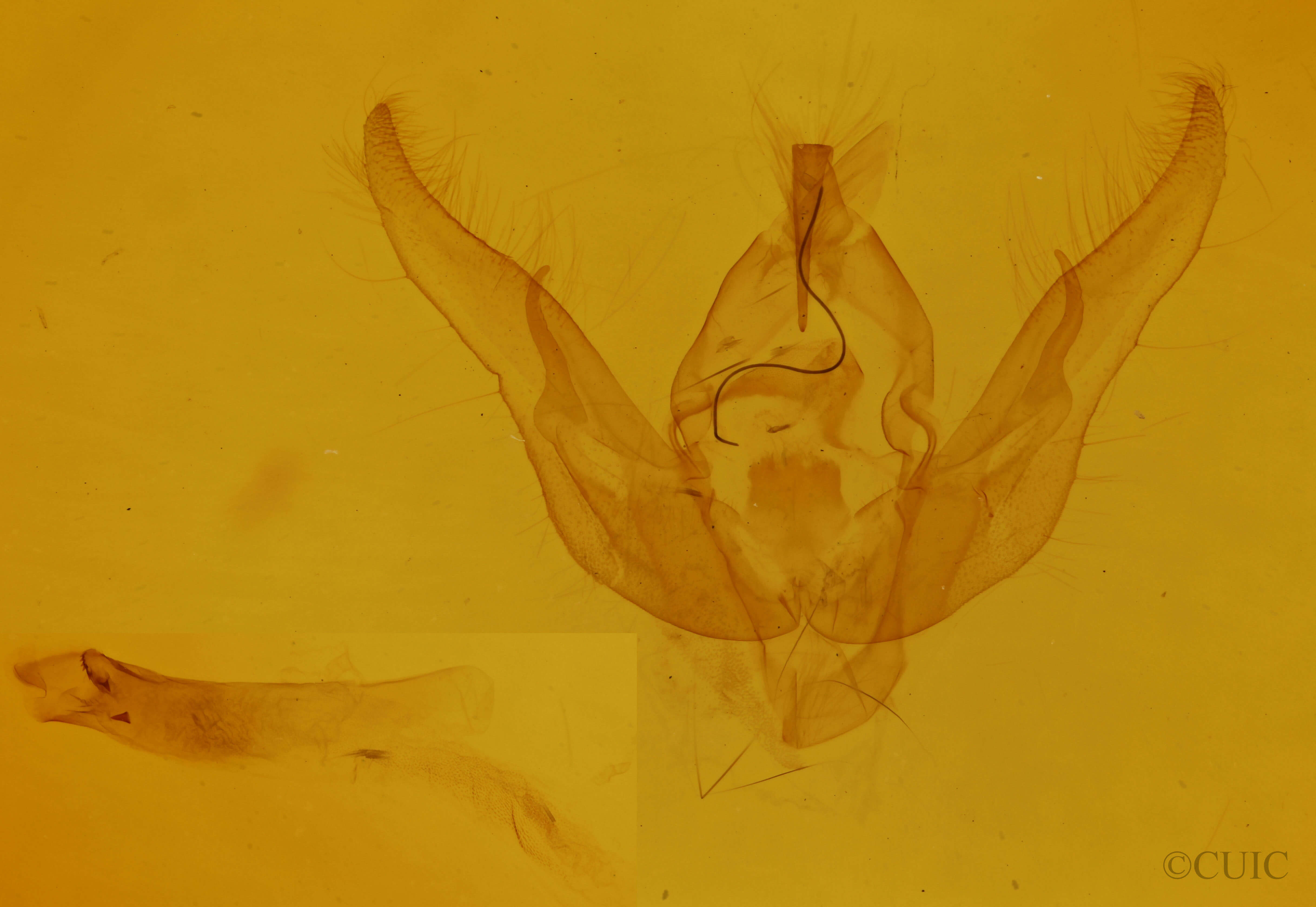genitalia view of adult Pseudanarta exasperata