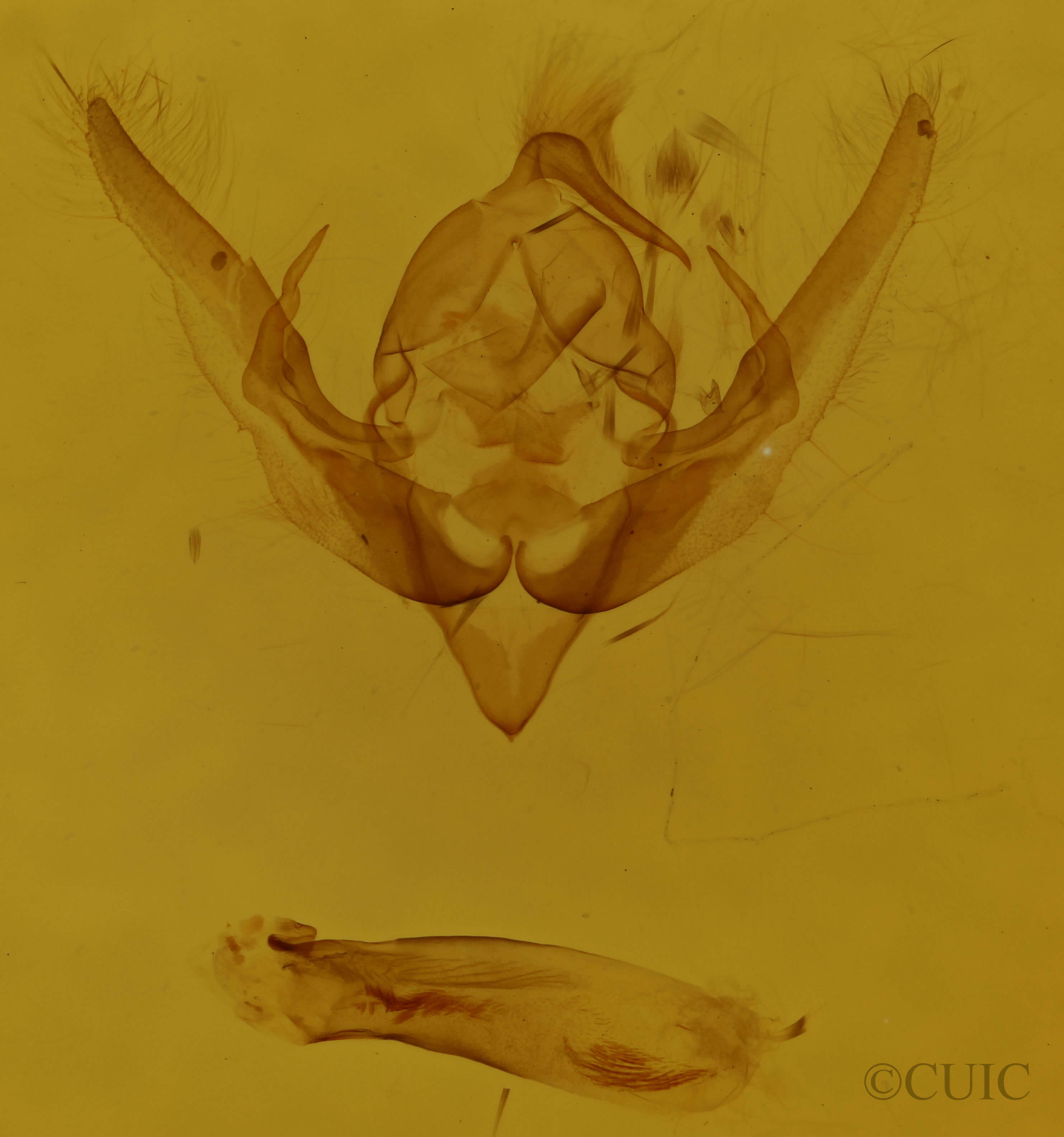 genitalia view of adult Pseudanarta flava