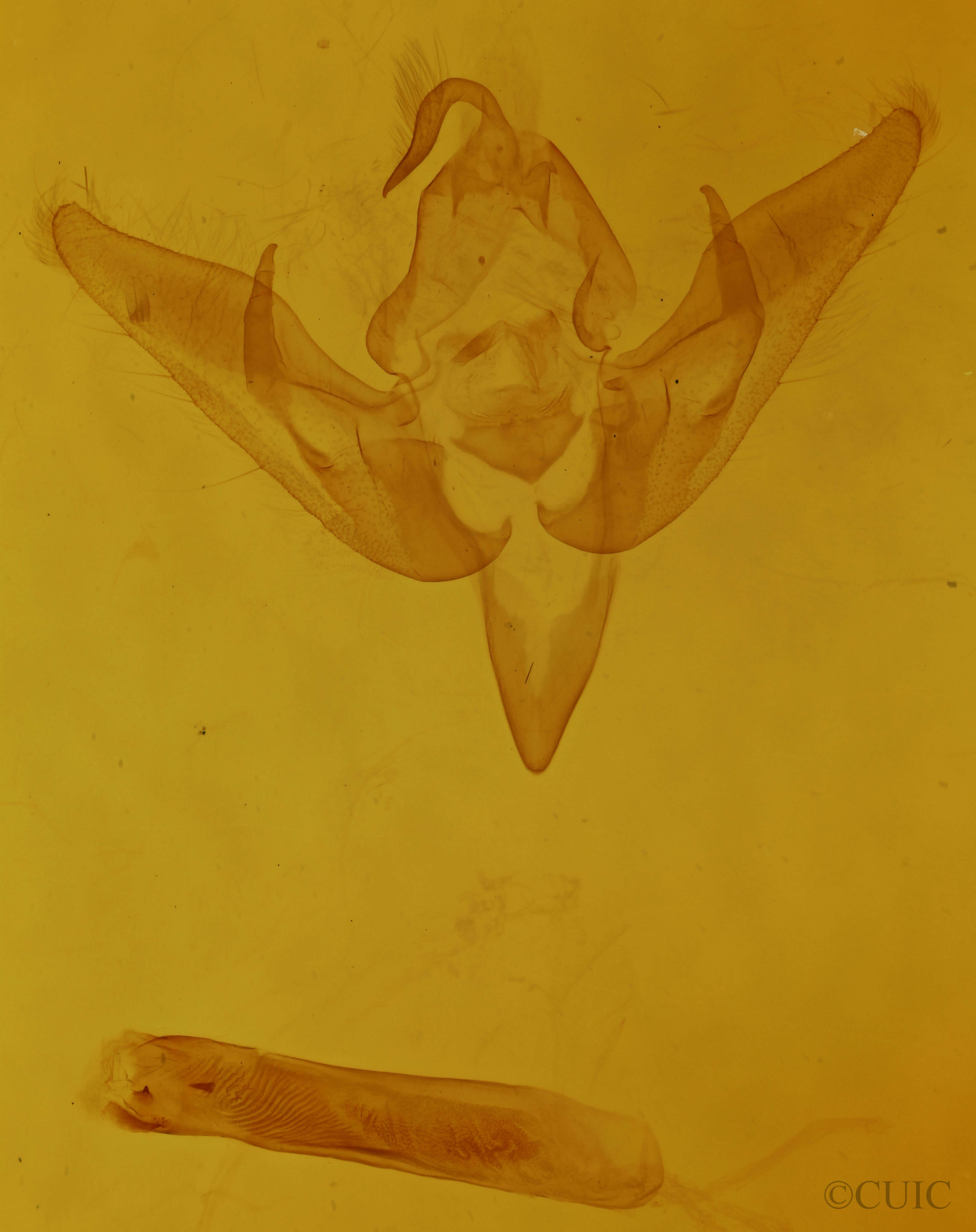 genitalia view of adult Pseudanarta flavidens