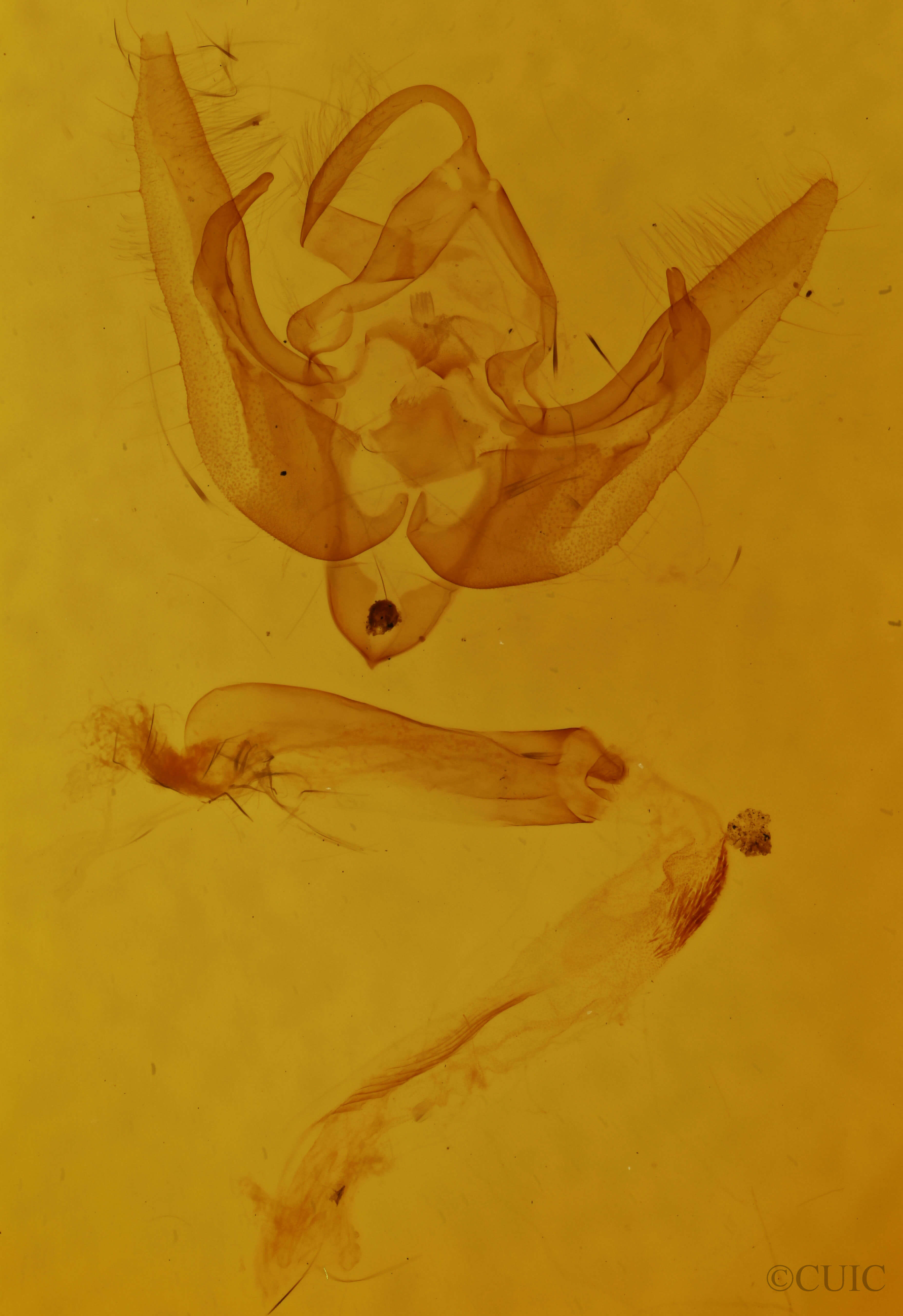 genitalia view of adult Pseudanarta singula