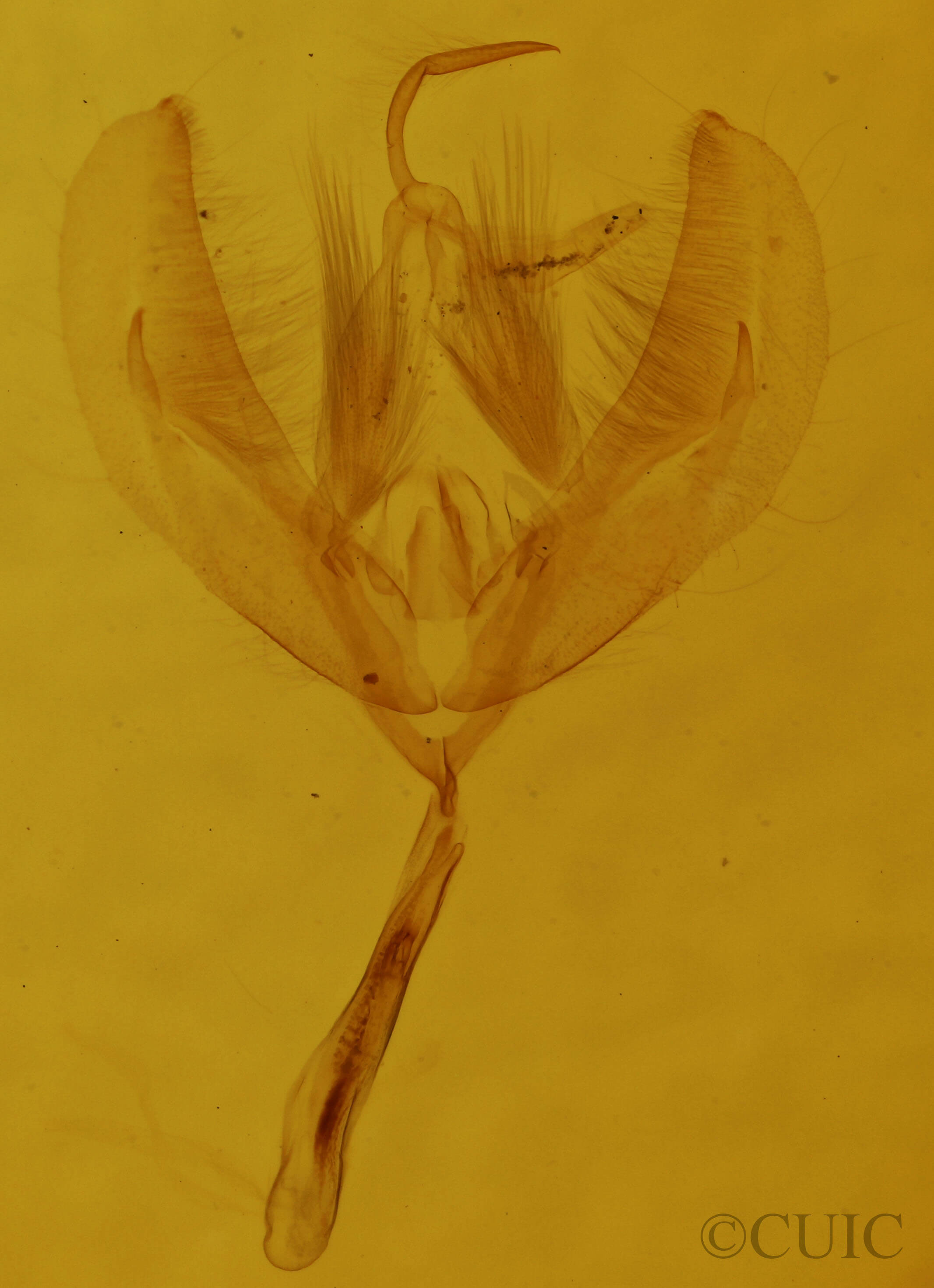 genitalia view of adult Pseudeustrotia carneola