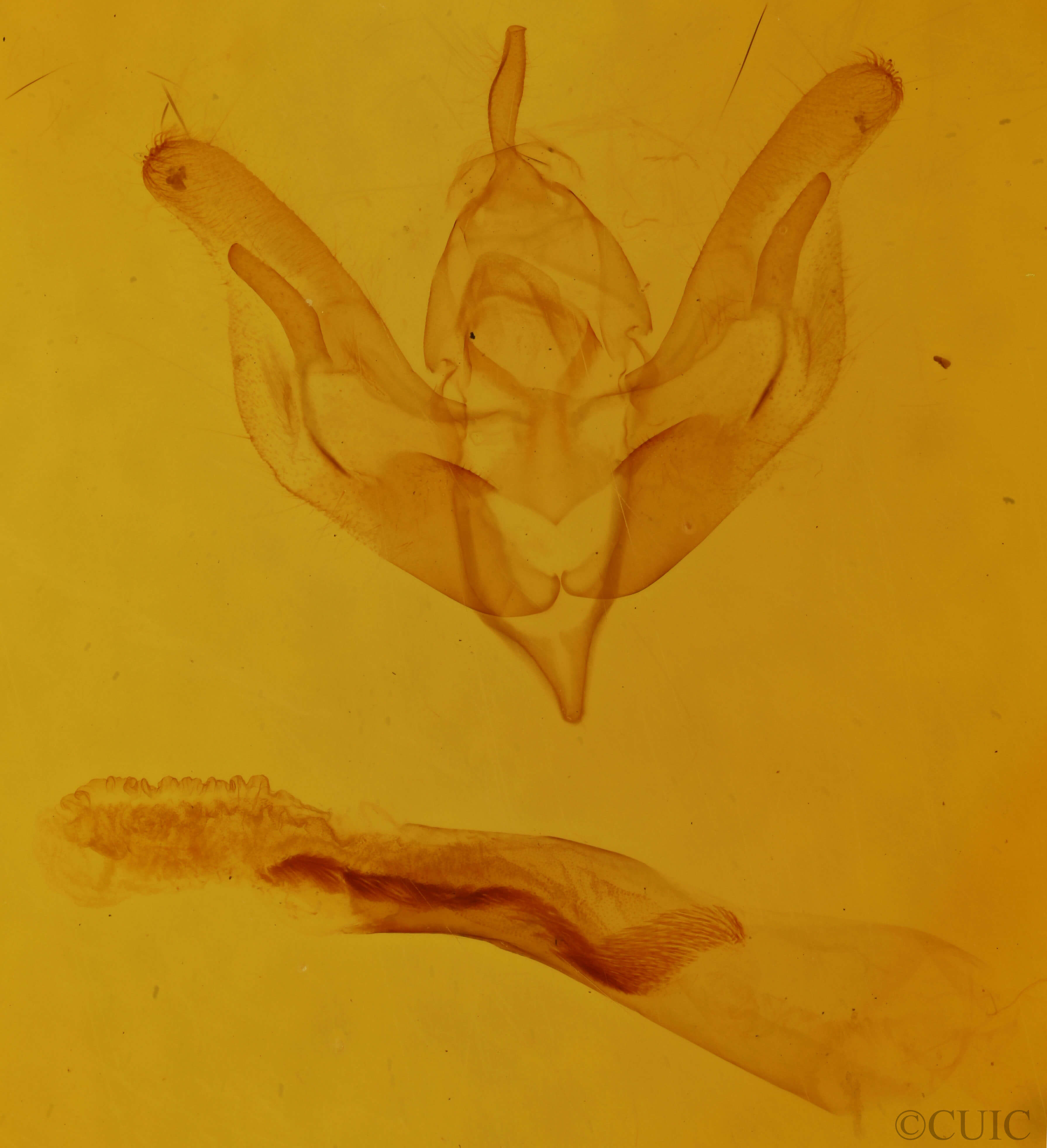 genitalia view of adult Trichocerapoda oblita
