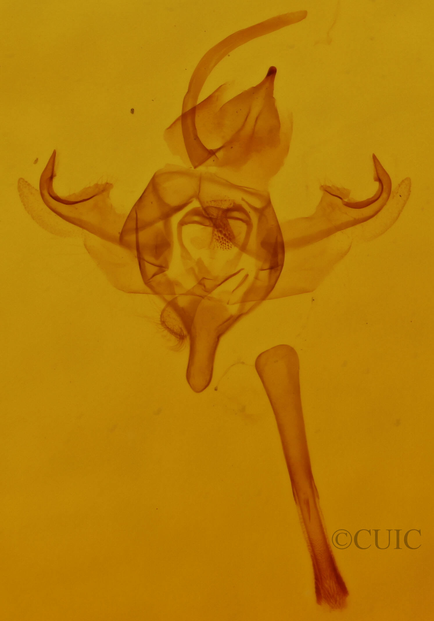 genitalia view of adult Xanthorhoe ferrugata