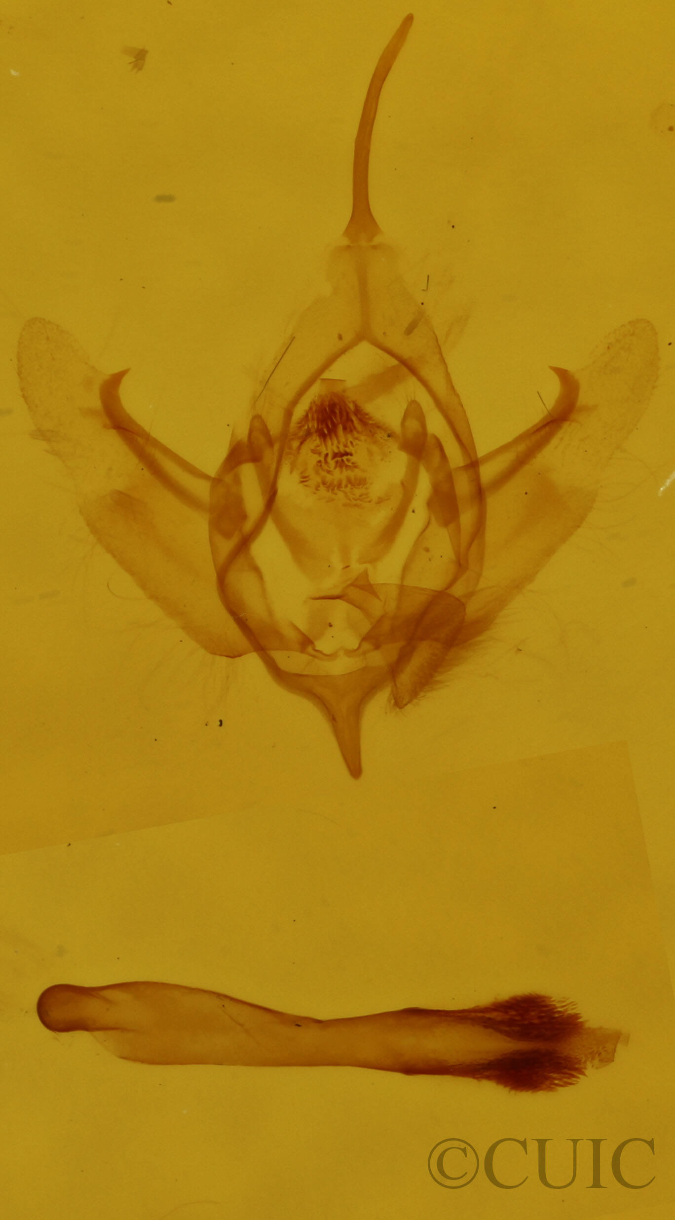 genitalia view of adult Xanthorhoe lacustrata