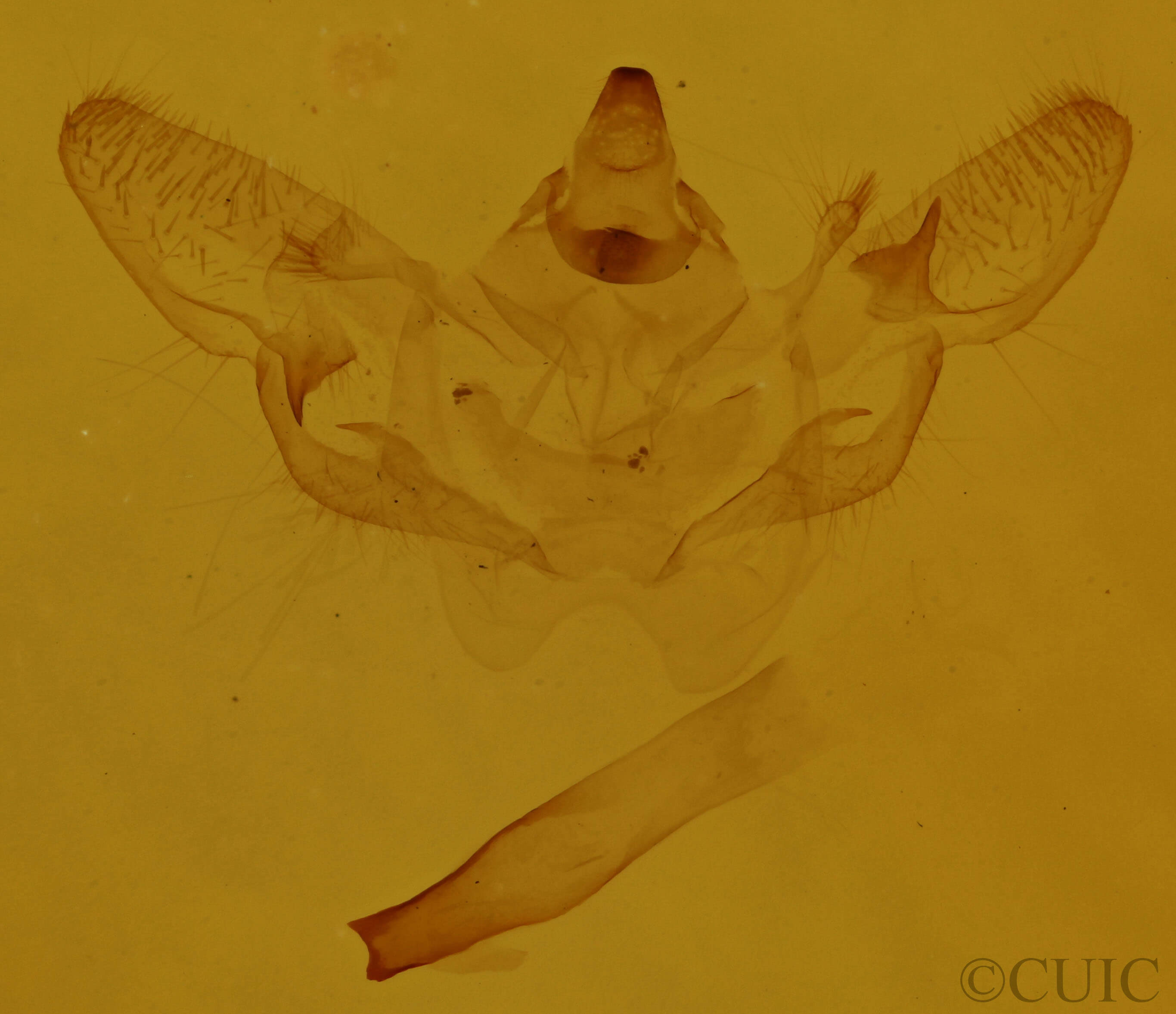 genitalia view of adult Xanthotype urticaria