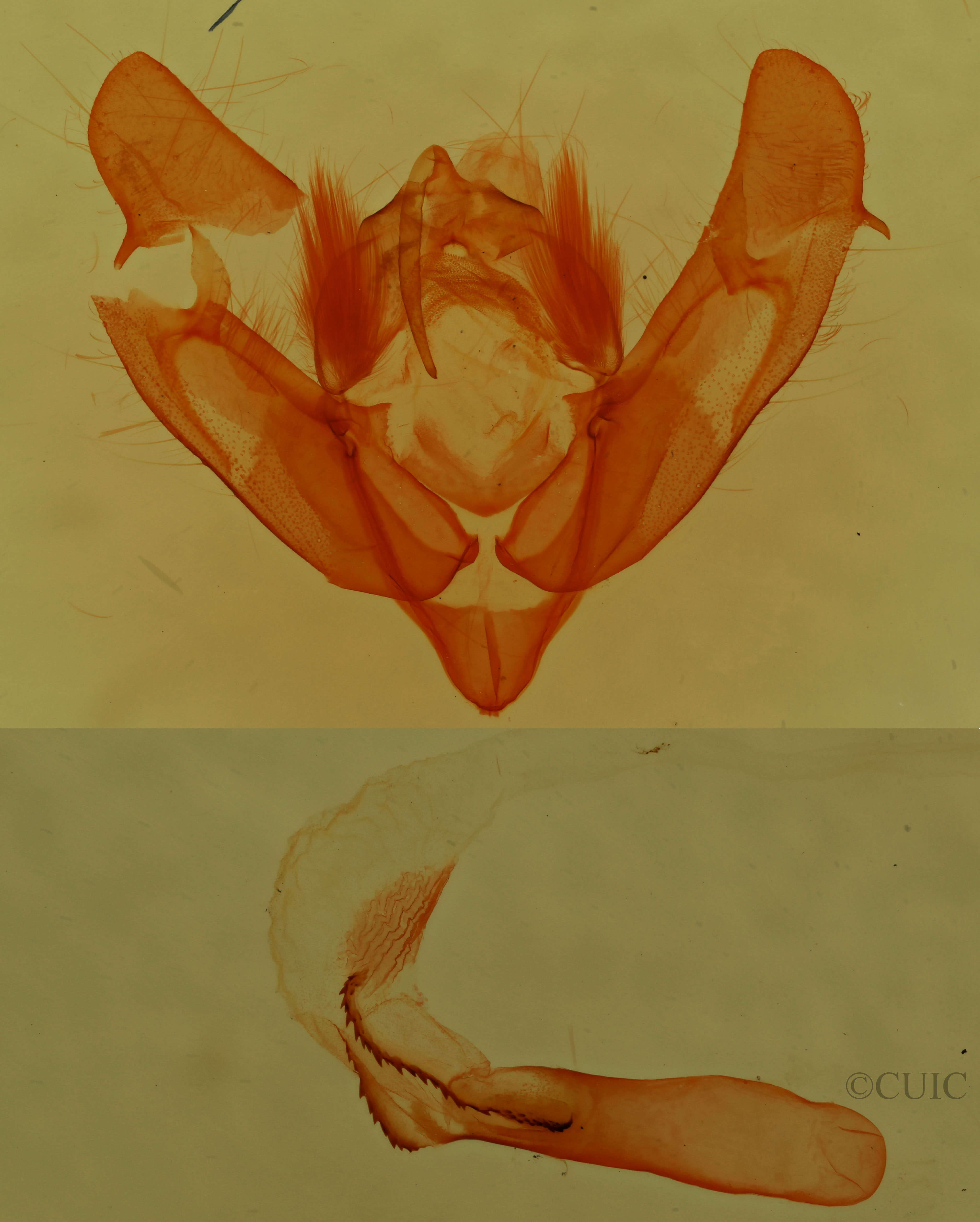 genitalia view of adult Xestia ochreago