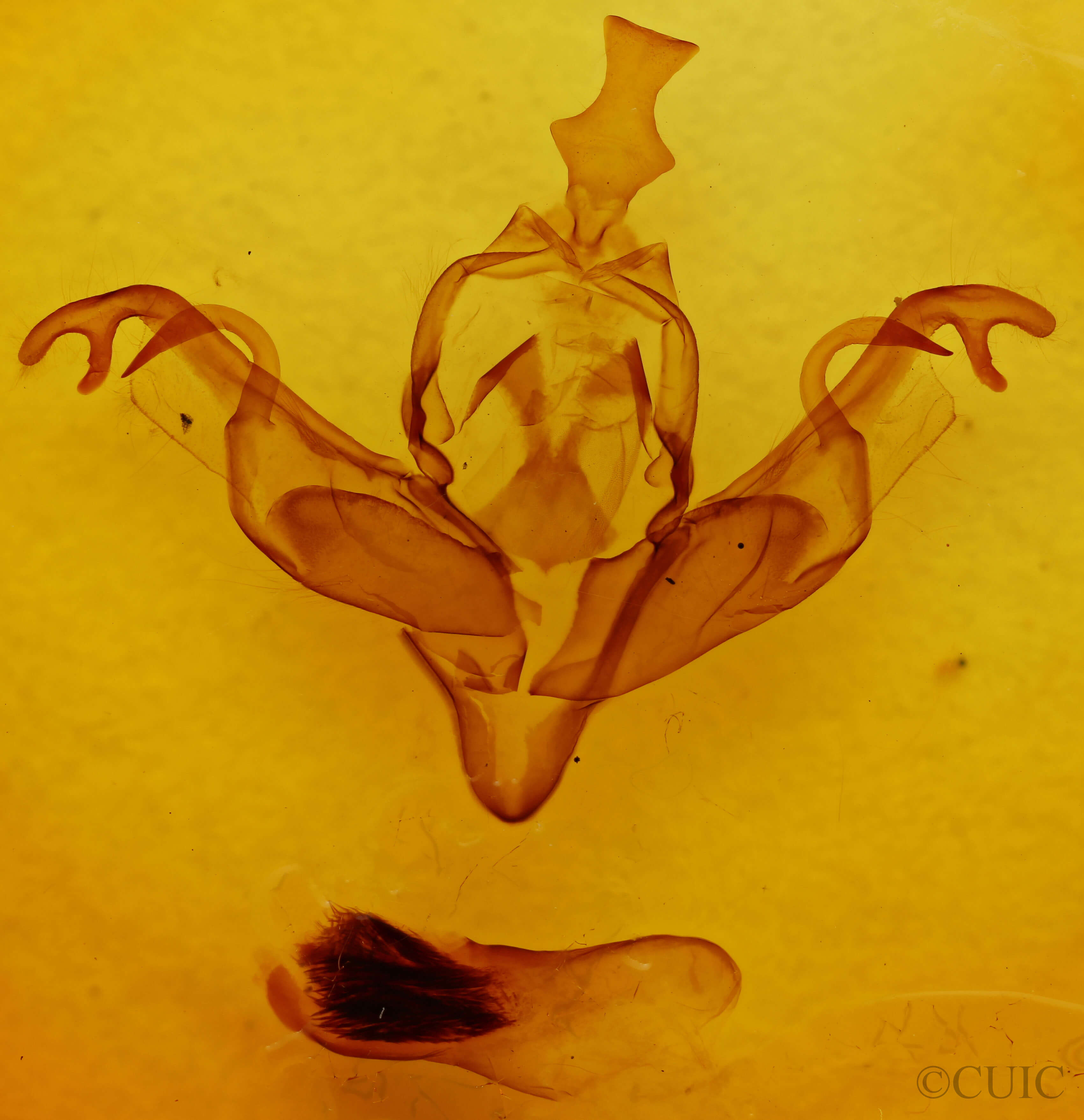 genitalia view of adult Xylena cineritia