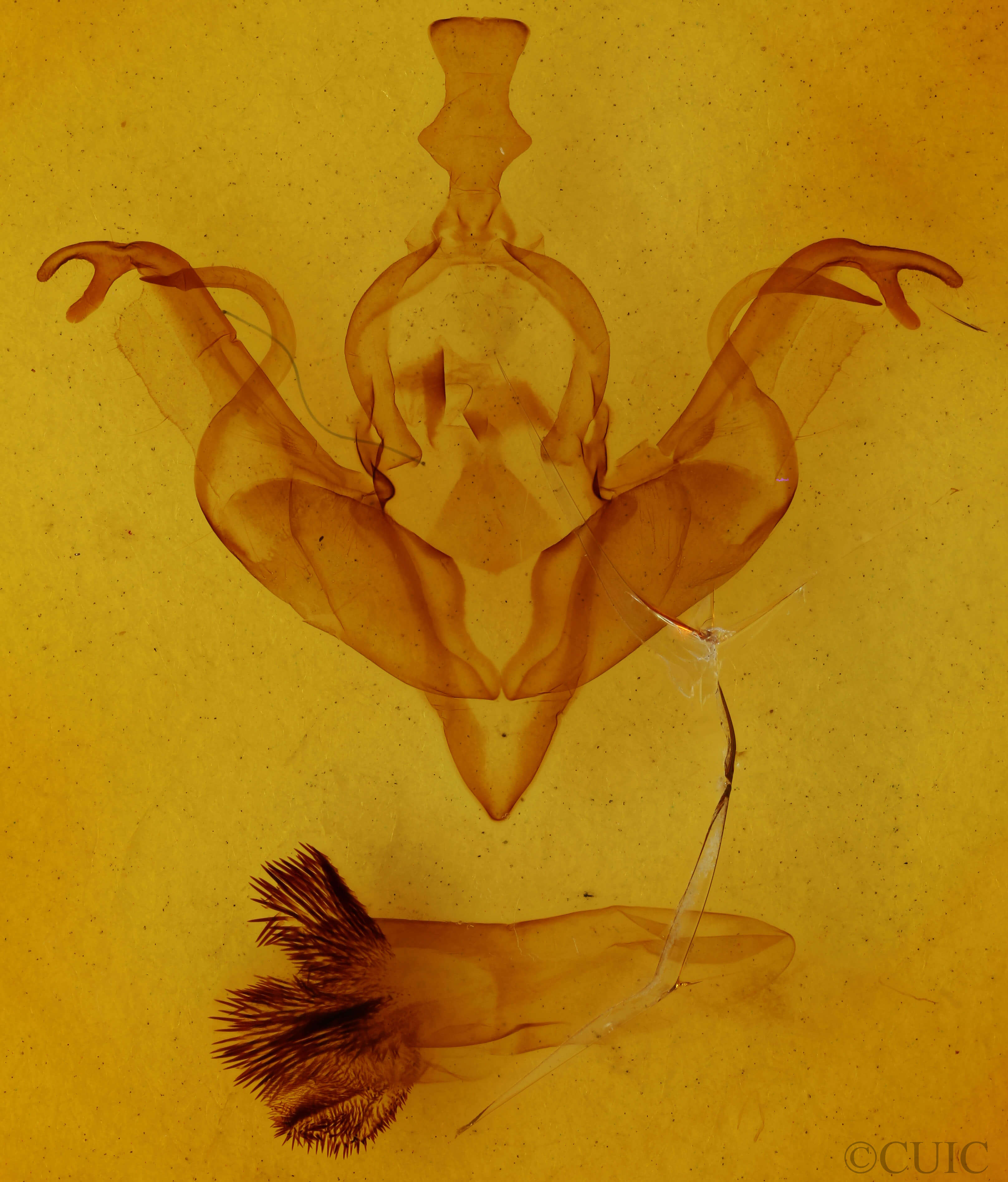 genitalia view of adult Xylena cineritia