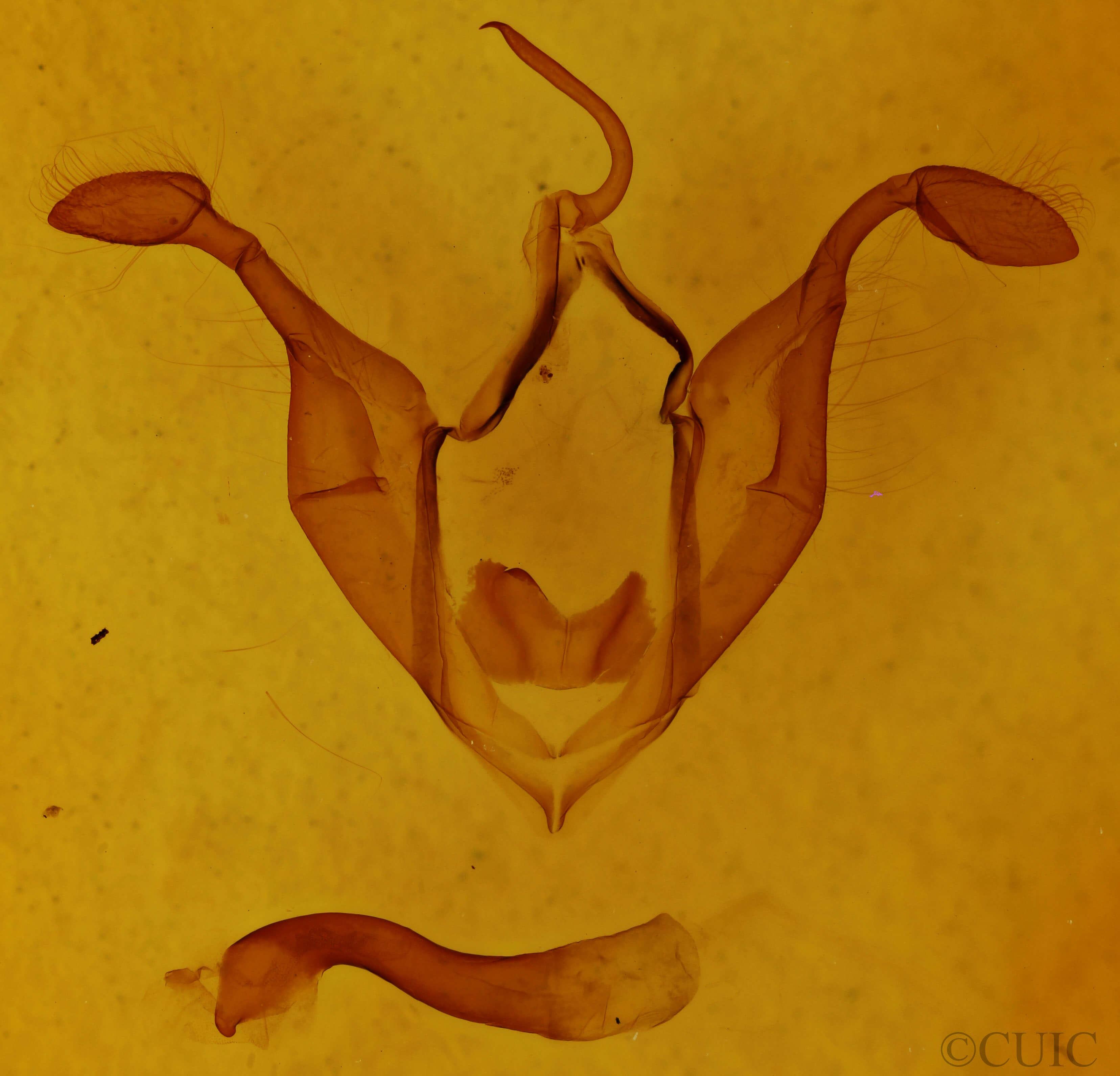 genitalia view of adult Zale lunifera