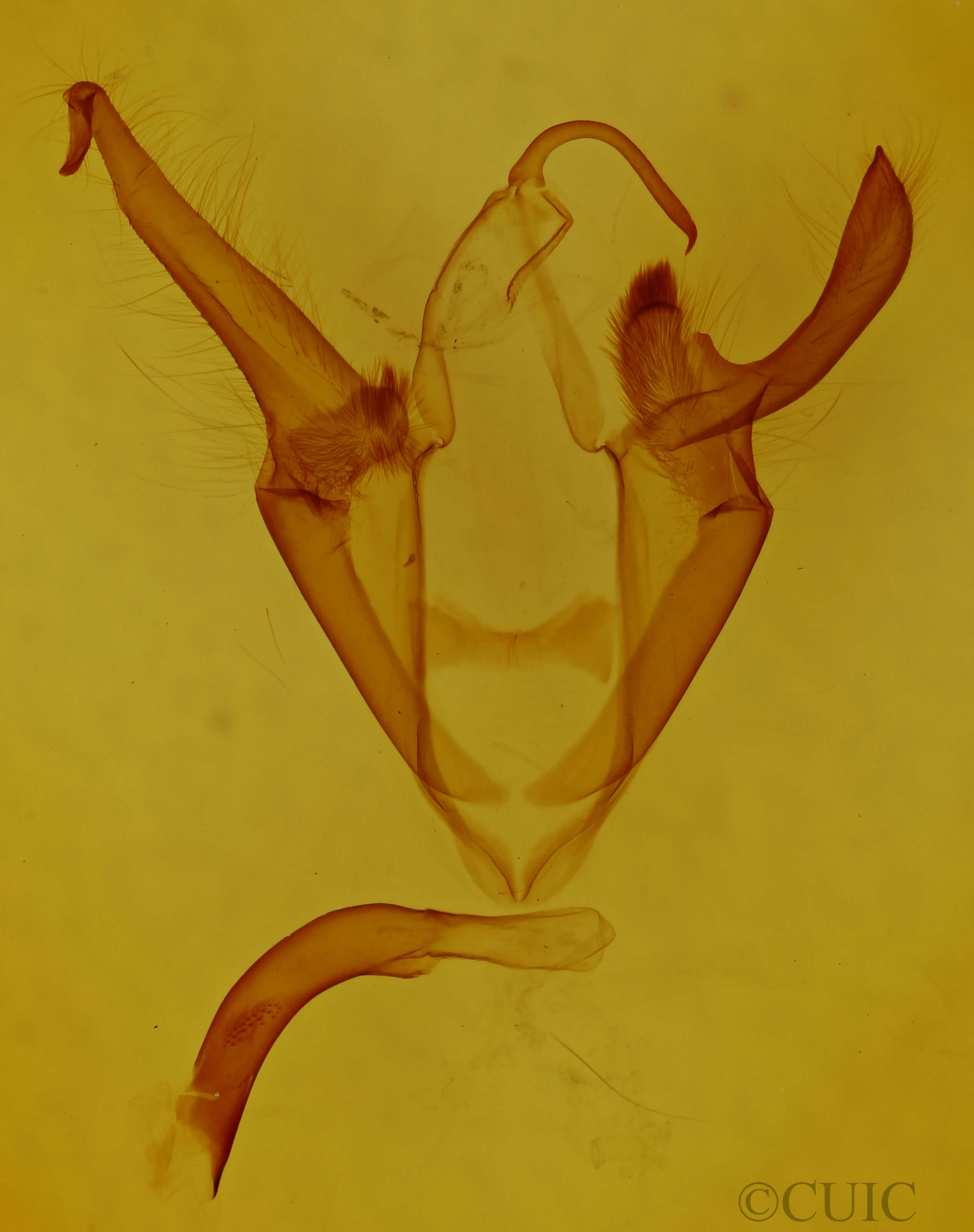 genitalia view of adult Zale duplicata