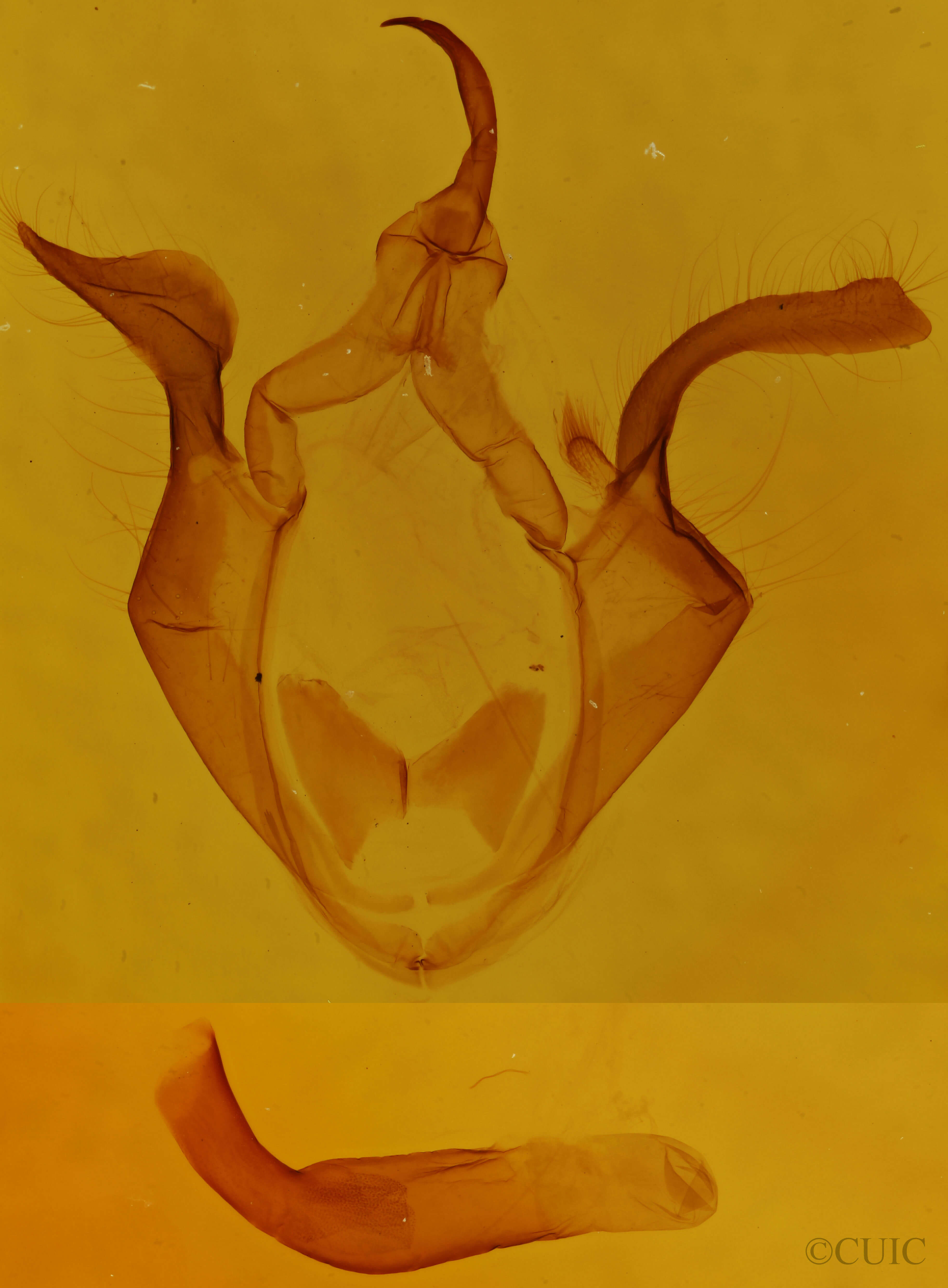 genitalia view of adult Zale horrida