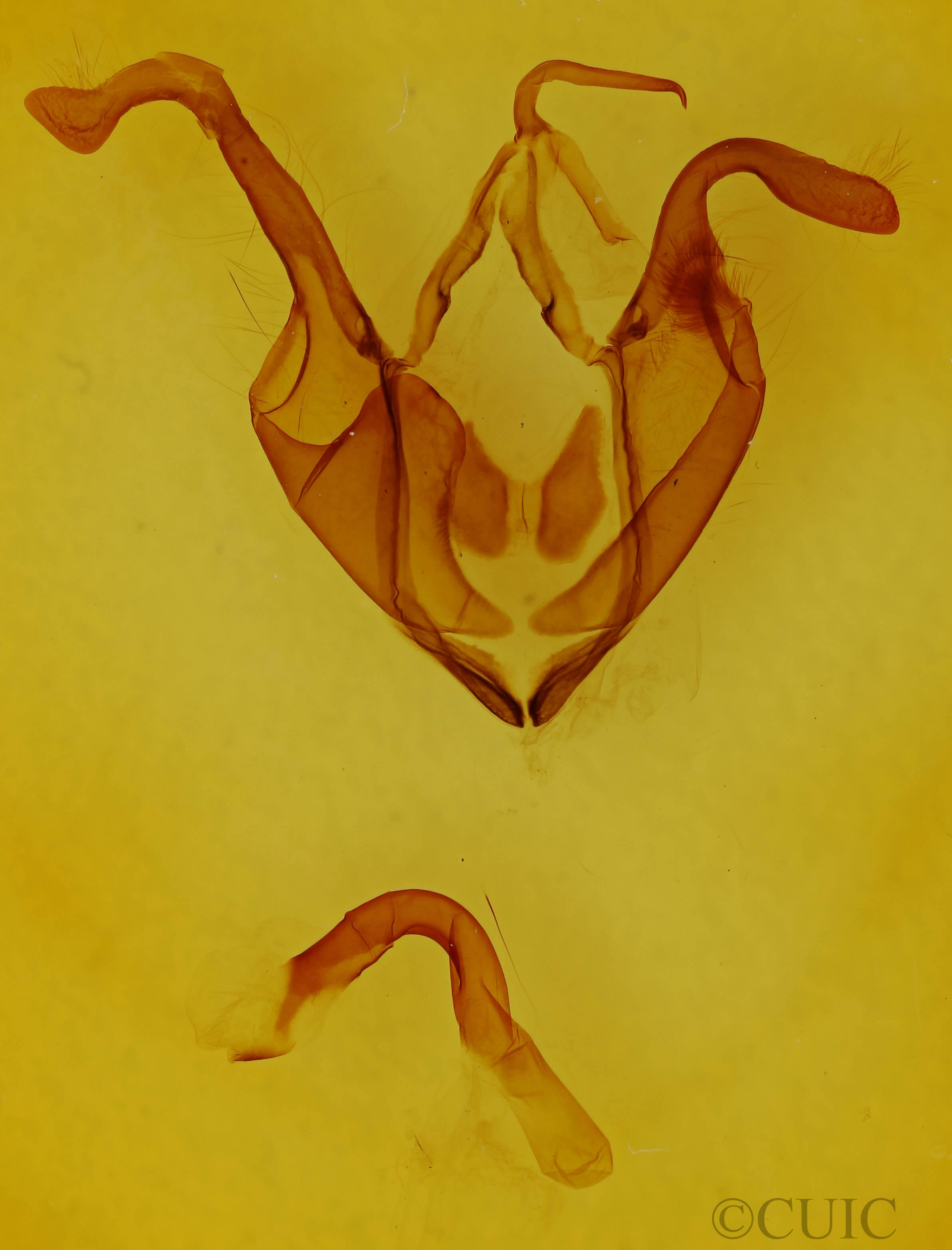 genitalia view of adult Zale undularis