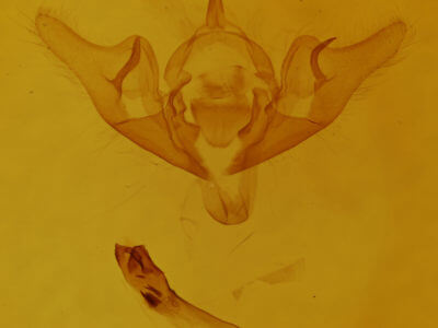 genitalia view of adult Abrostola urentis