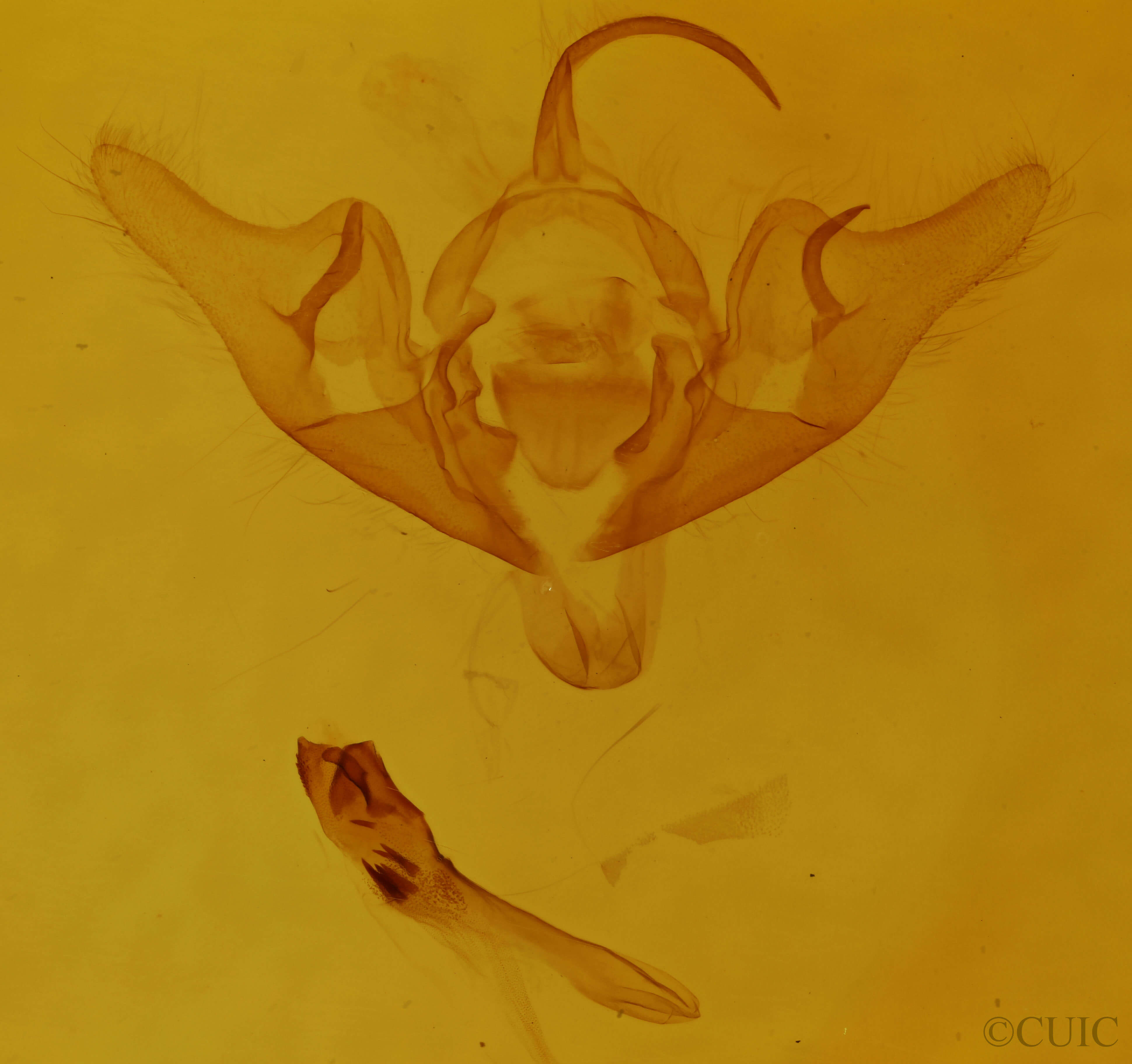 genitalia view of adult Abrostola urentis