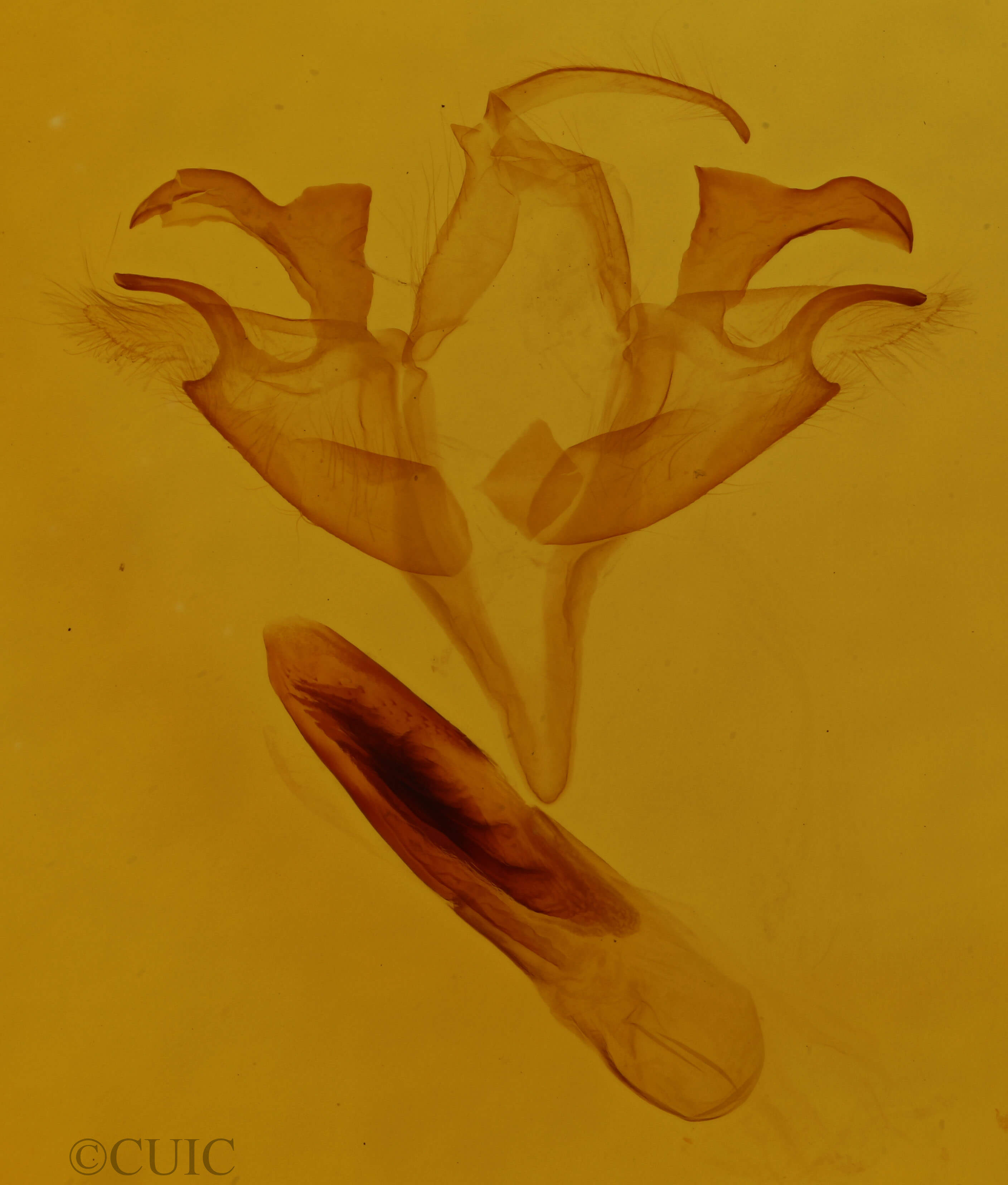 genitalia view of adult Acronicta retardata