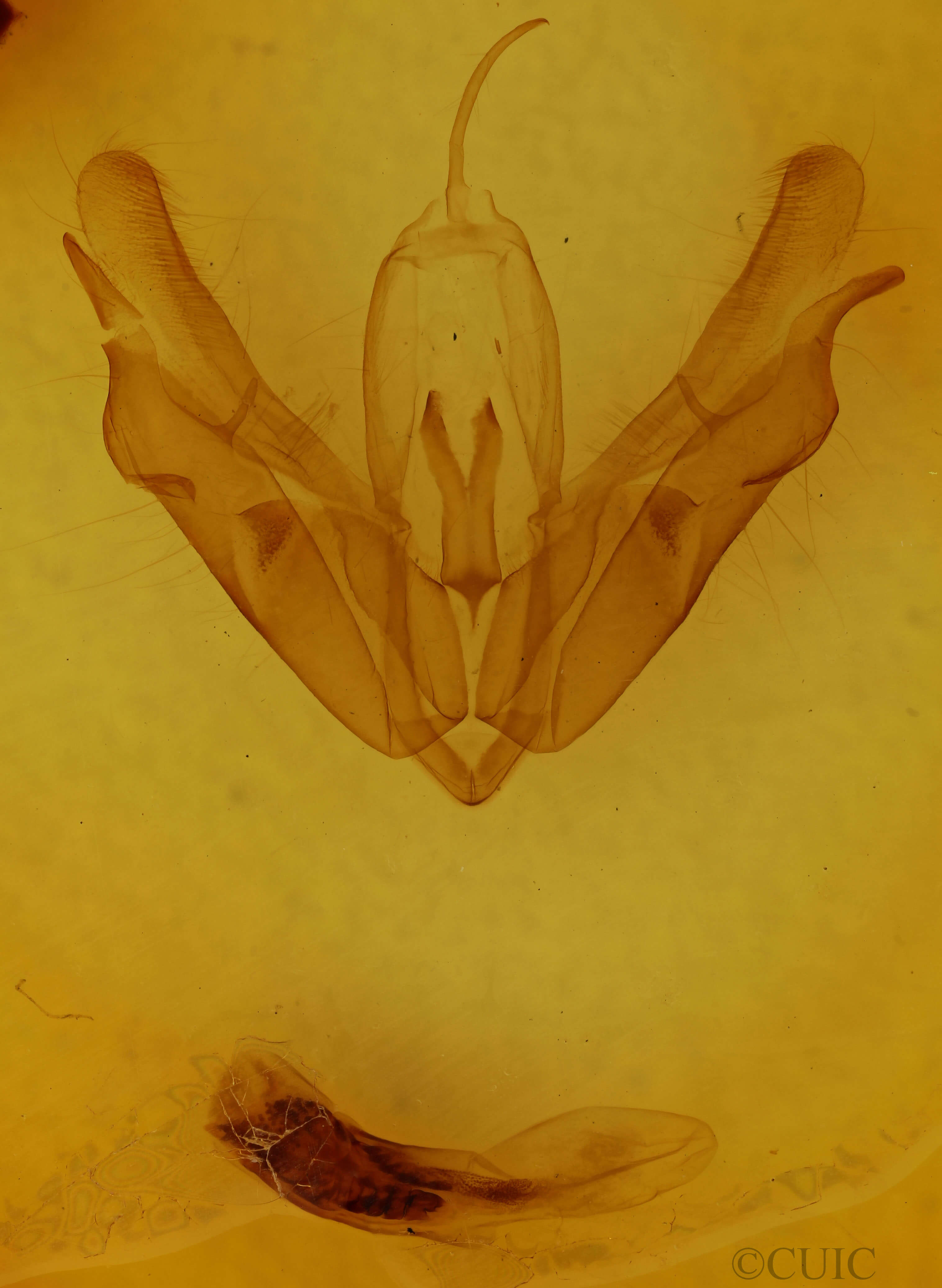 genitalia view of adult Acronicta spinigera